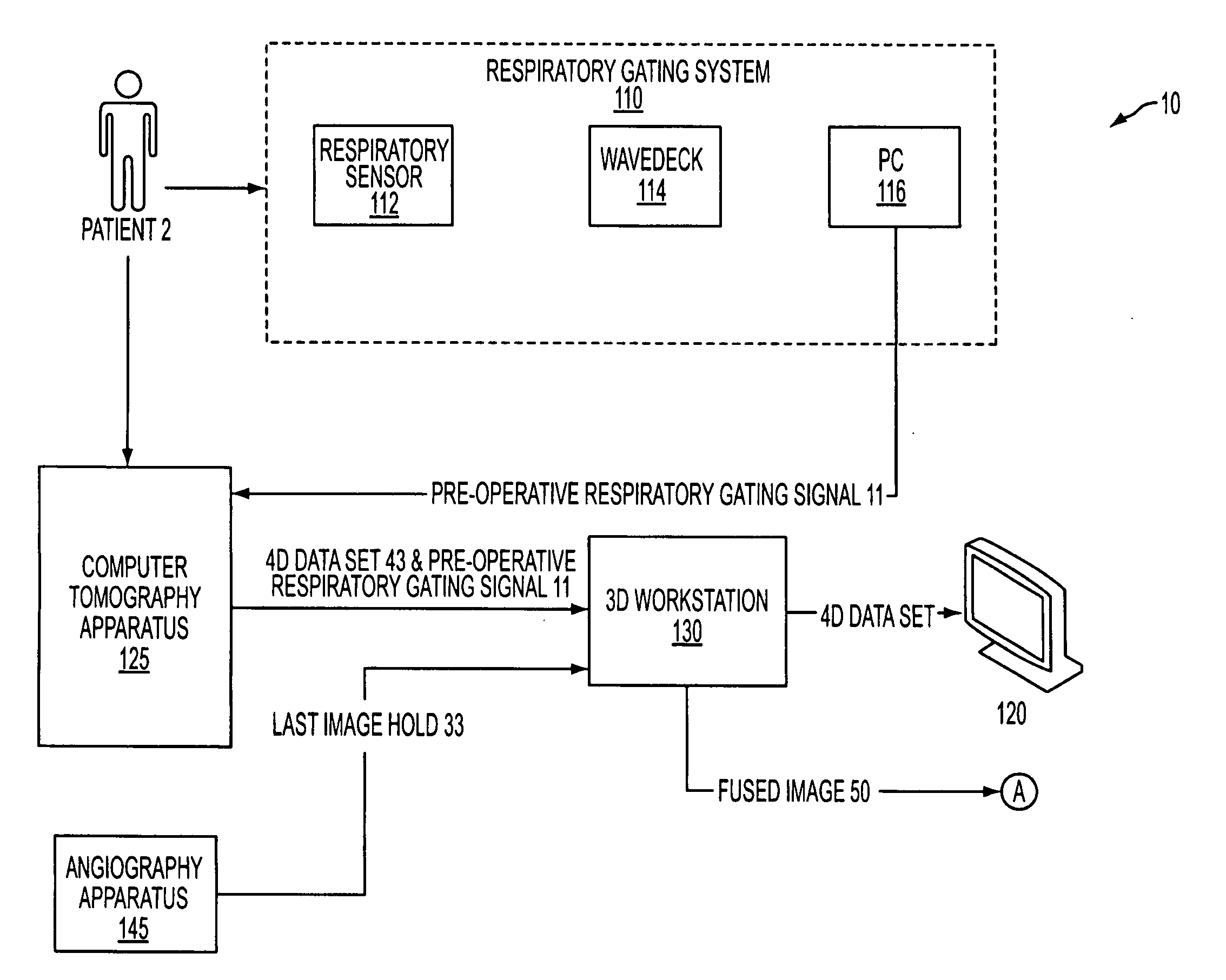 Respiratory gated image fusion of computed tomography 3D images and live fluoroscopy images