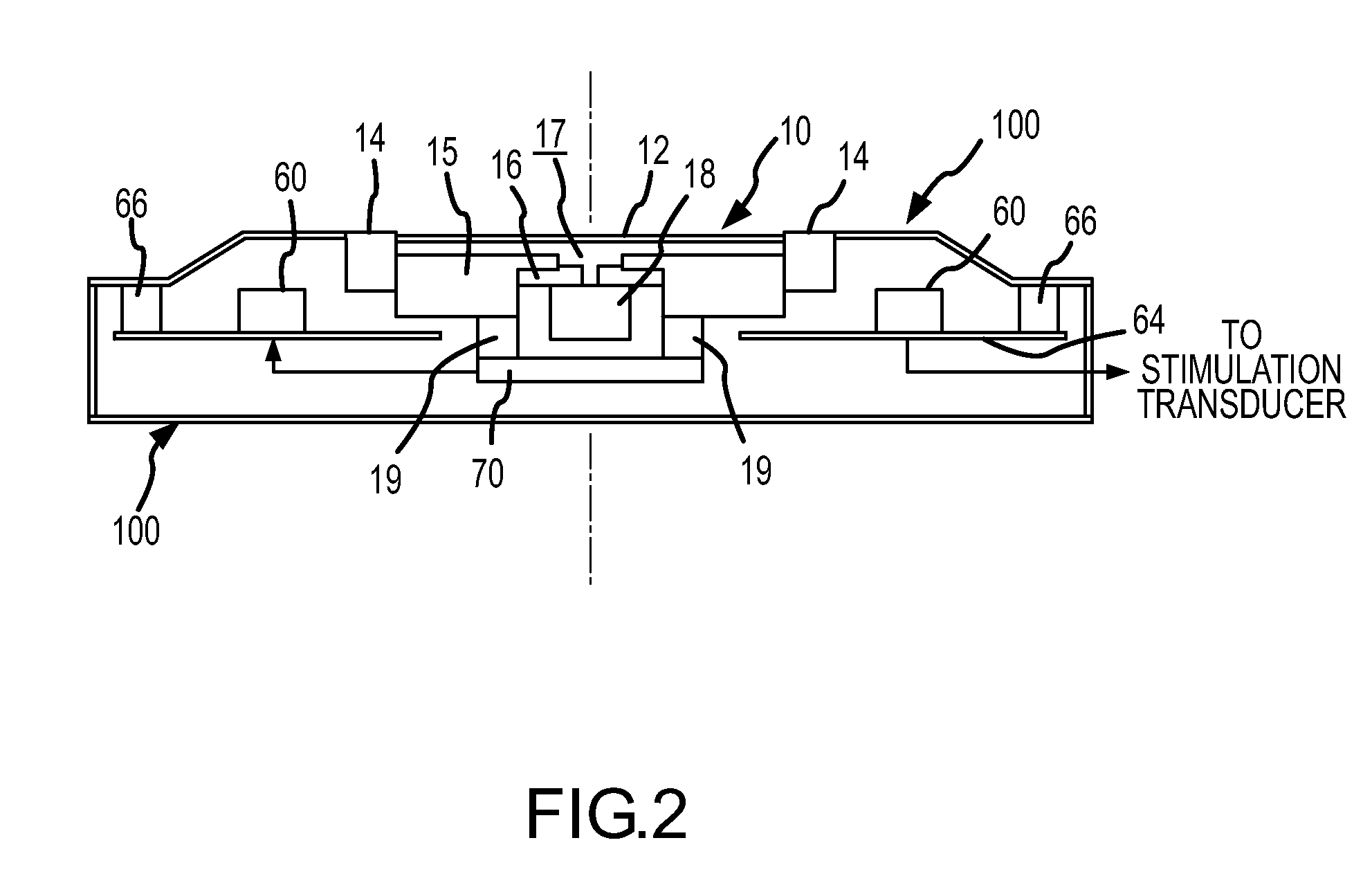 Dual feedback control system for implantable hearing instrument