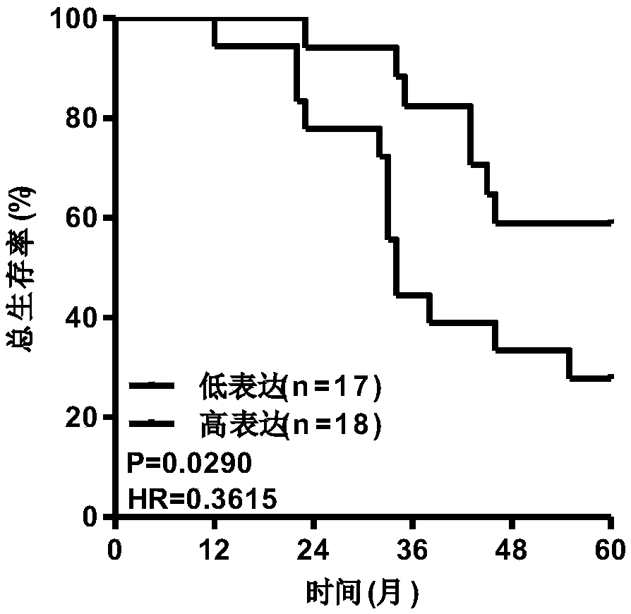 Application of long-chain non-coding RNA LINC00336 as biomarker in preparing lung squamous cell carcinoma prognosis detection preparation