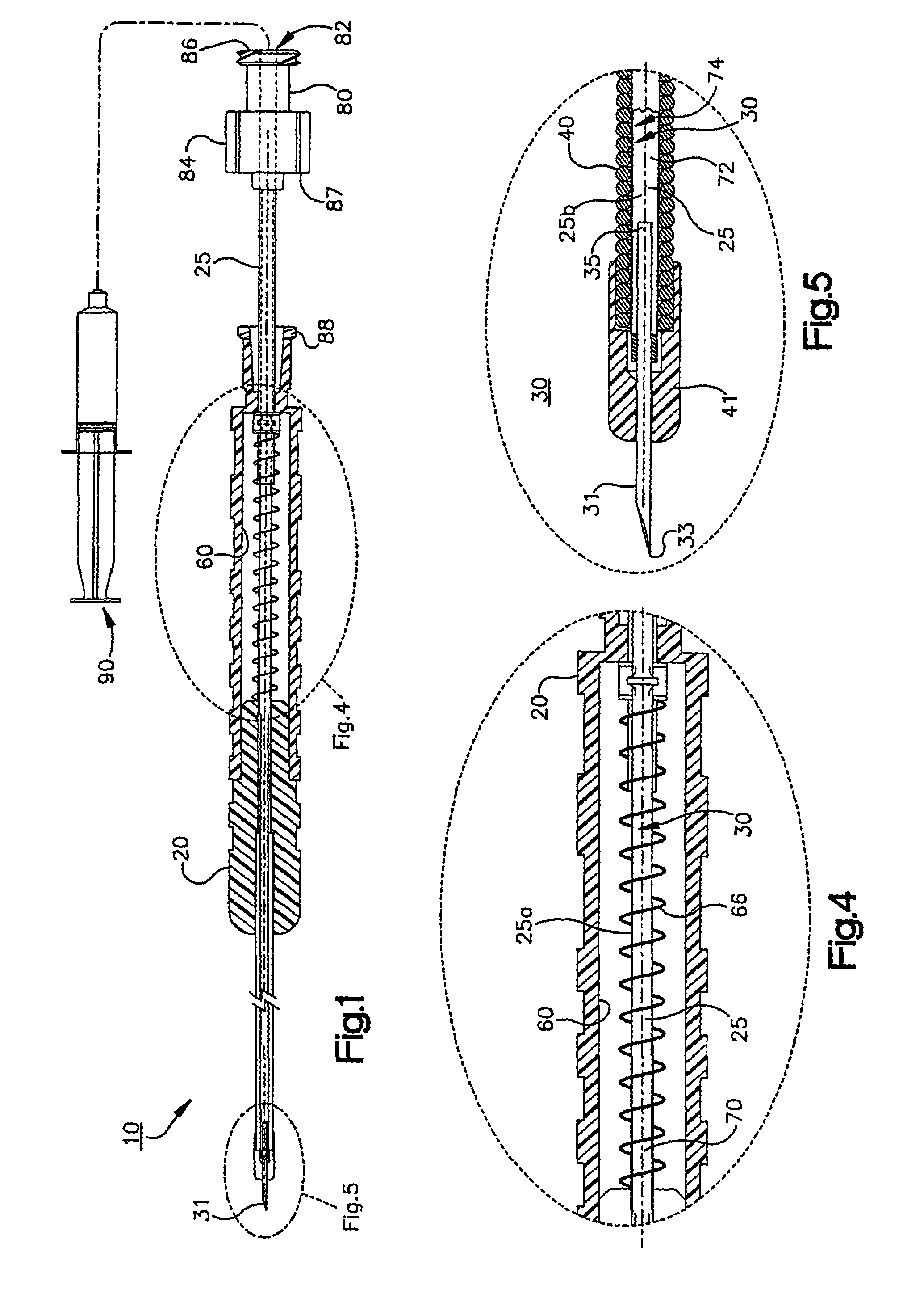 Duodenoscope needle