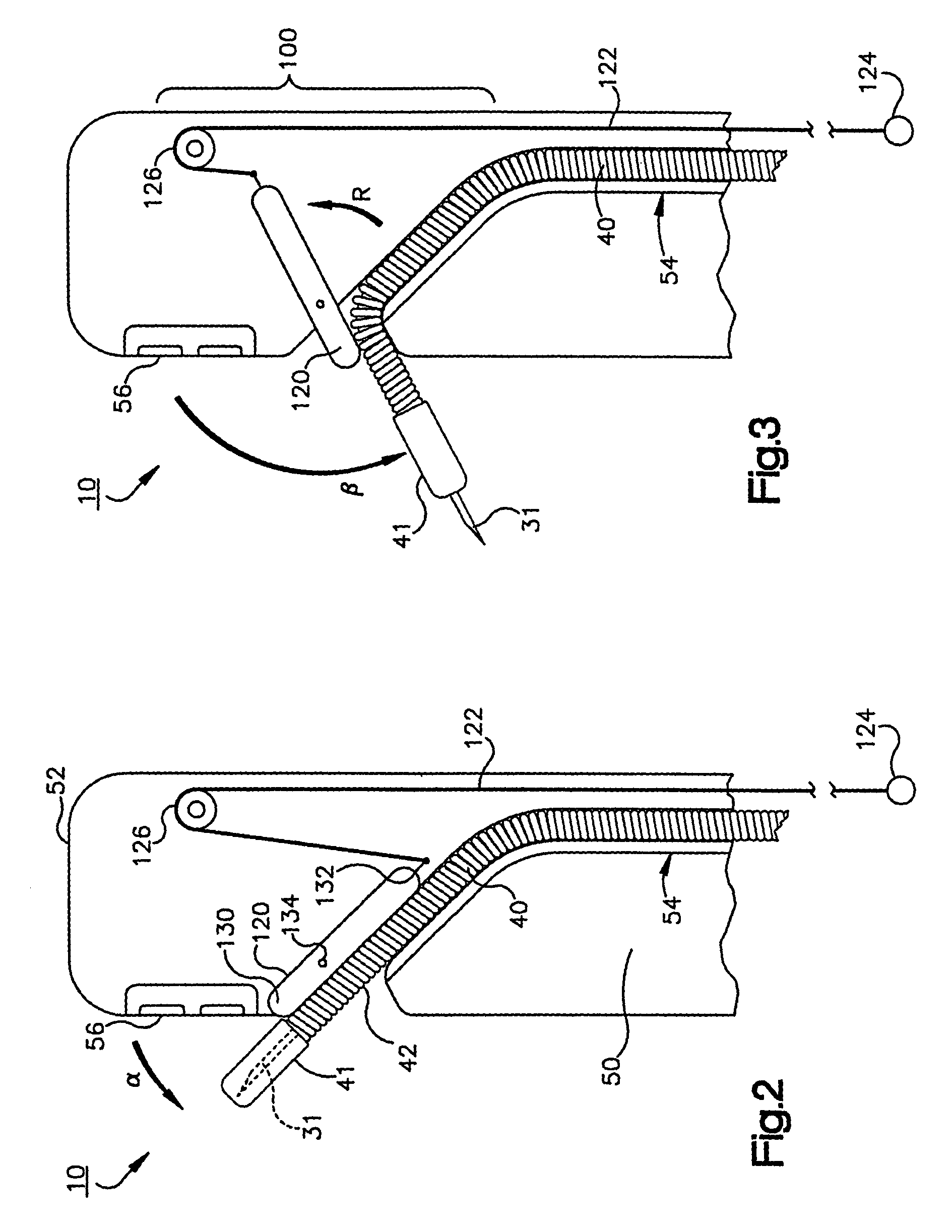 Duodenoscope needle