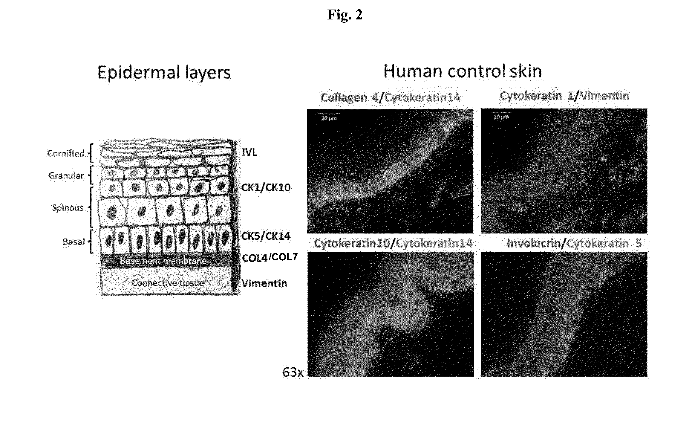 Engineered three-dimensional skin tissues, arrays thereof, and methods of making the same