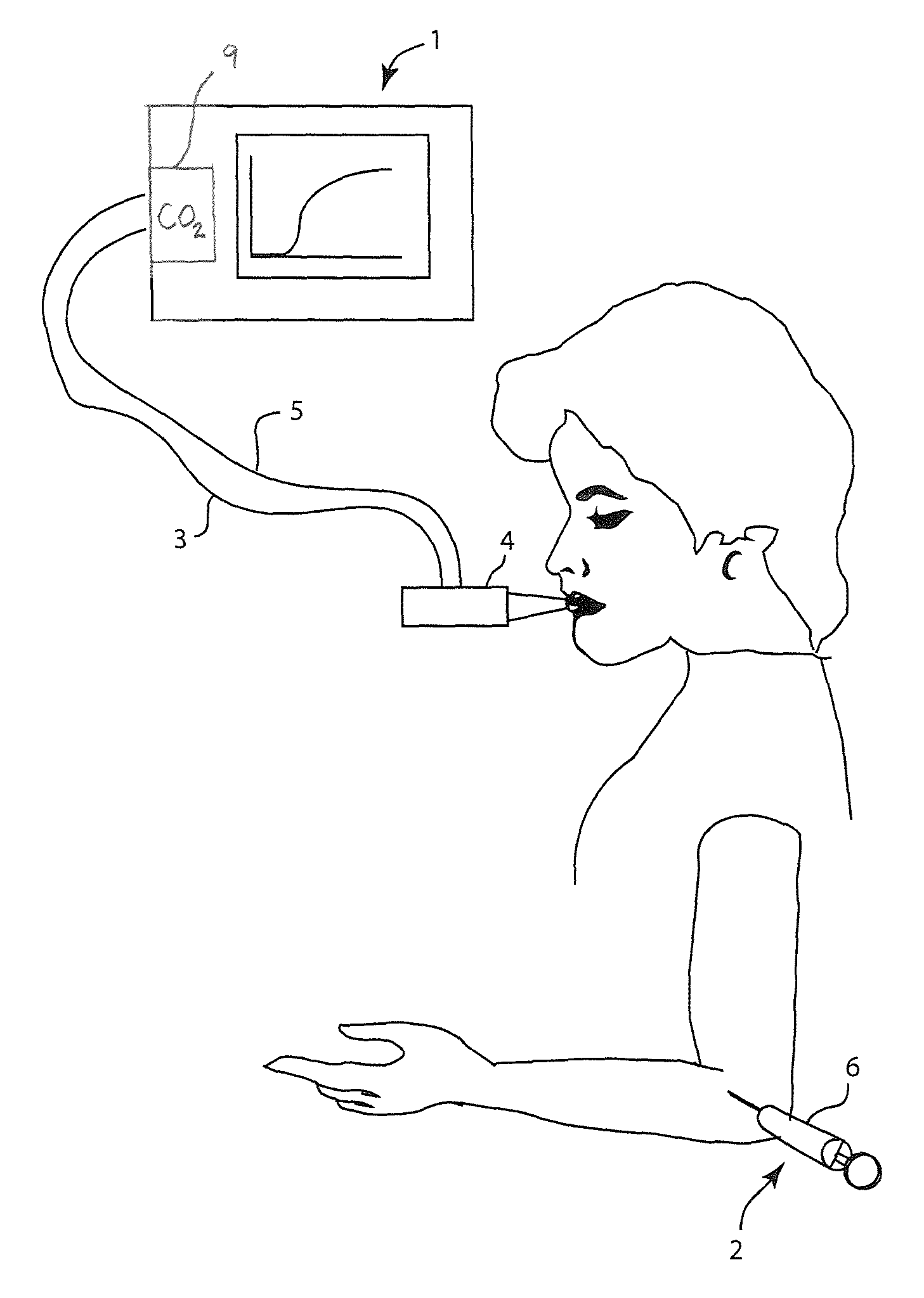 Method and apparatus for indicating the absence of a pulmonary embolism in a patient