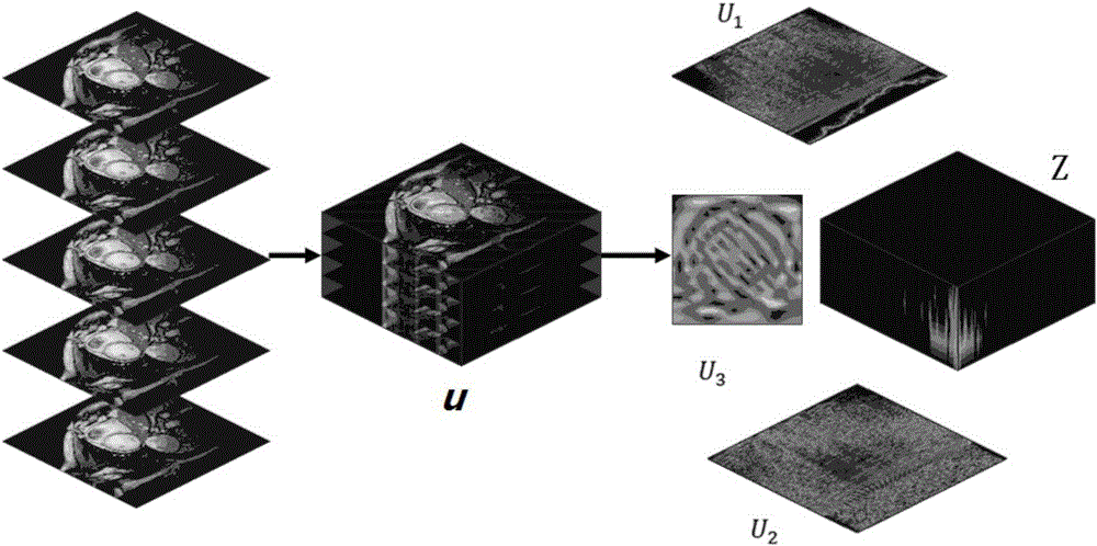 A 3D Cardiac Magnetic Resonance Imaging Method Based on Tensor Decomposition Sparse Constraints