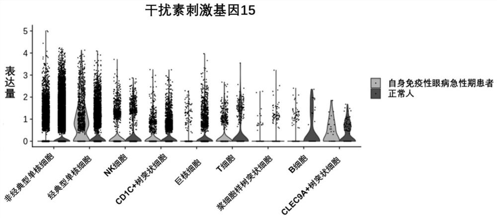 Application of interferon stimulating gene 15 in preparation of products for early diagnosis of autoimmune eye diseases