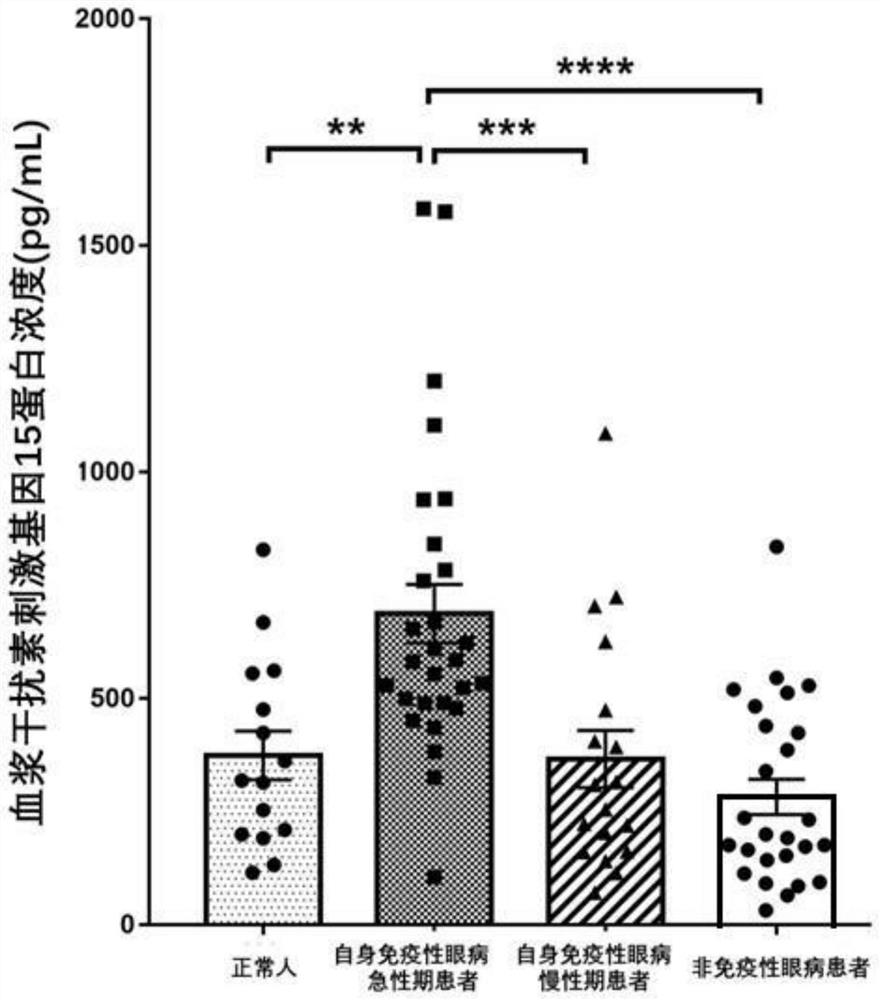 Application of interferon stimulating gene 15 in preparation of products for early diagnosis of autoimmune eye diseases