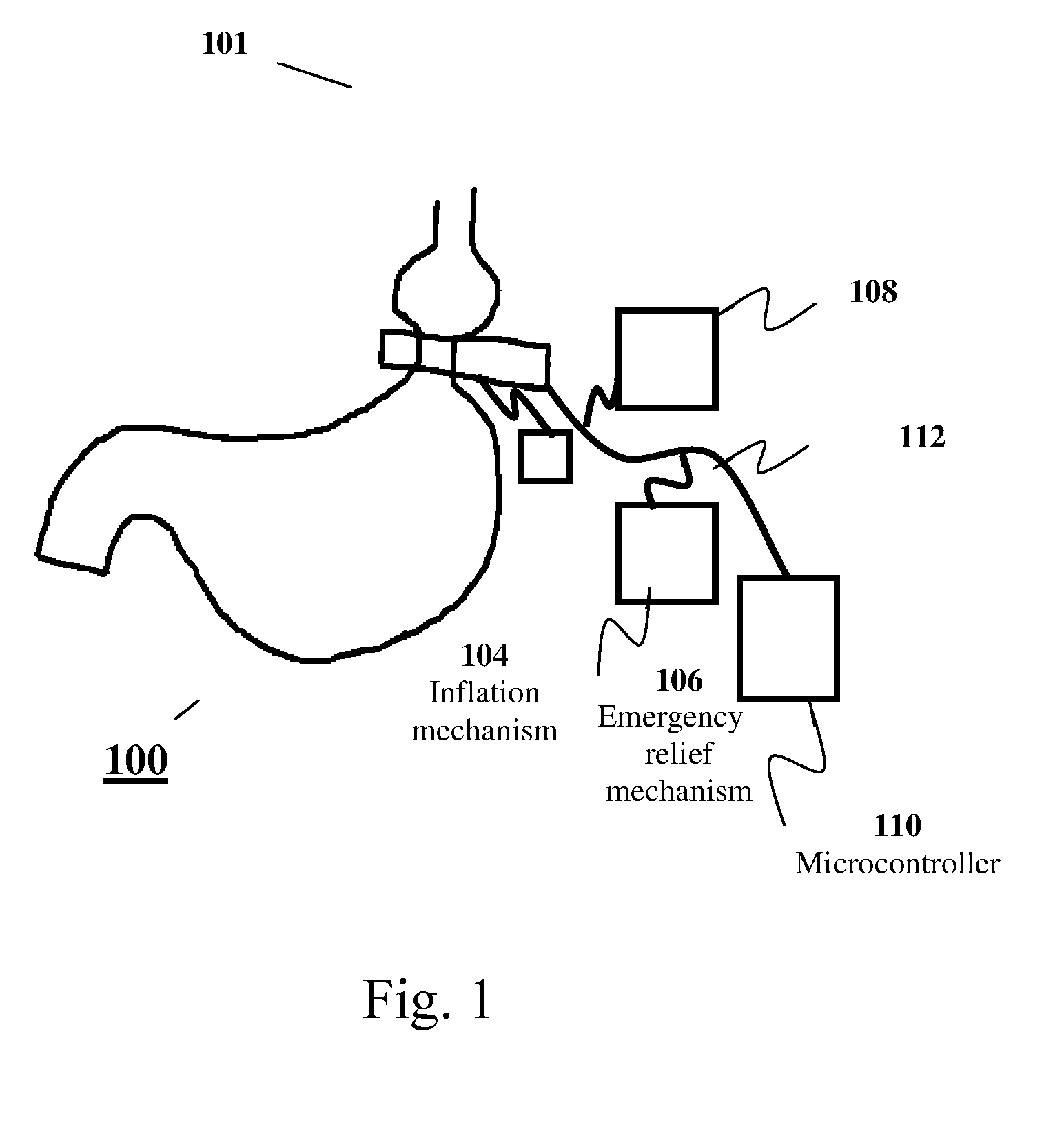 Apparatus and methods for corrective guidance of eating behavior after weight loss surgery