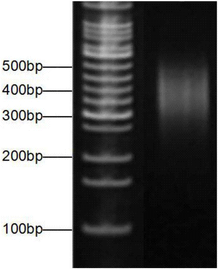 Detection method of adult type polycystic kidney