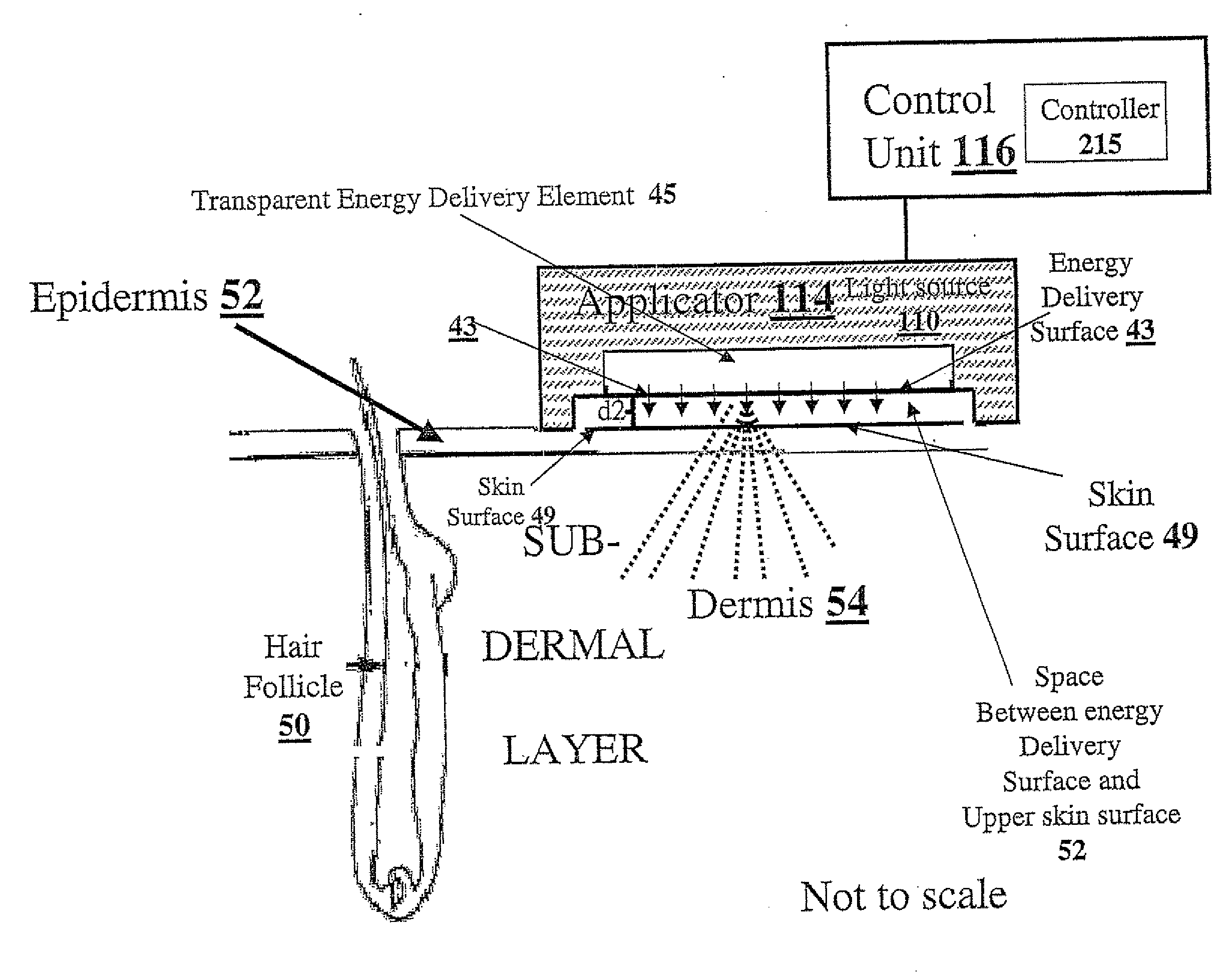 Method and apparatus for light-based hair removal