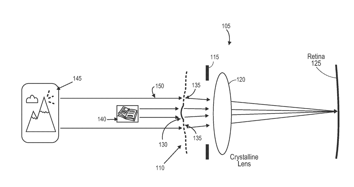 Methods of correcting vision