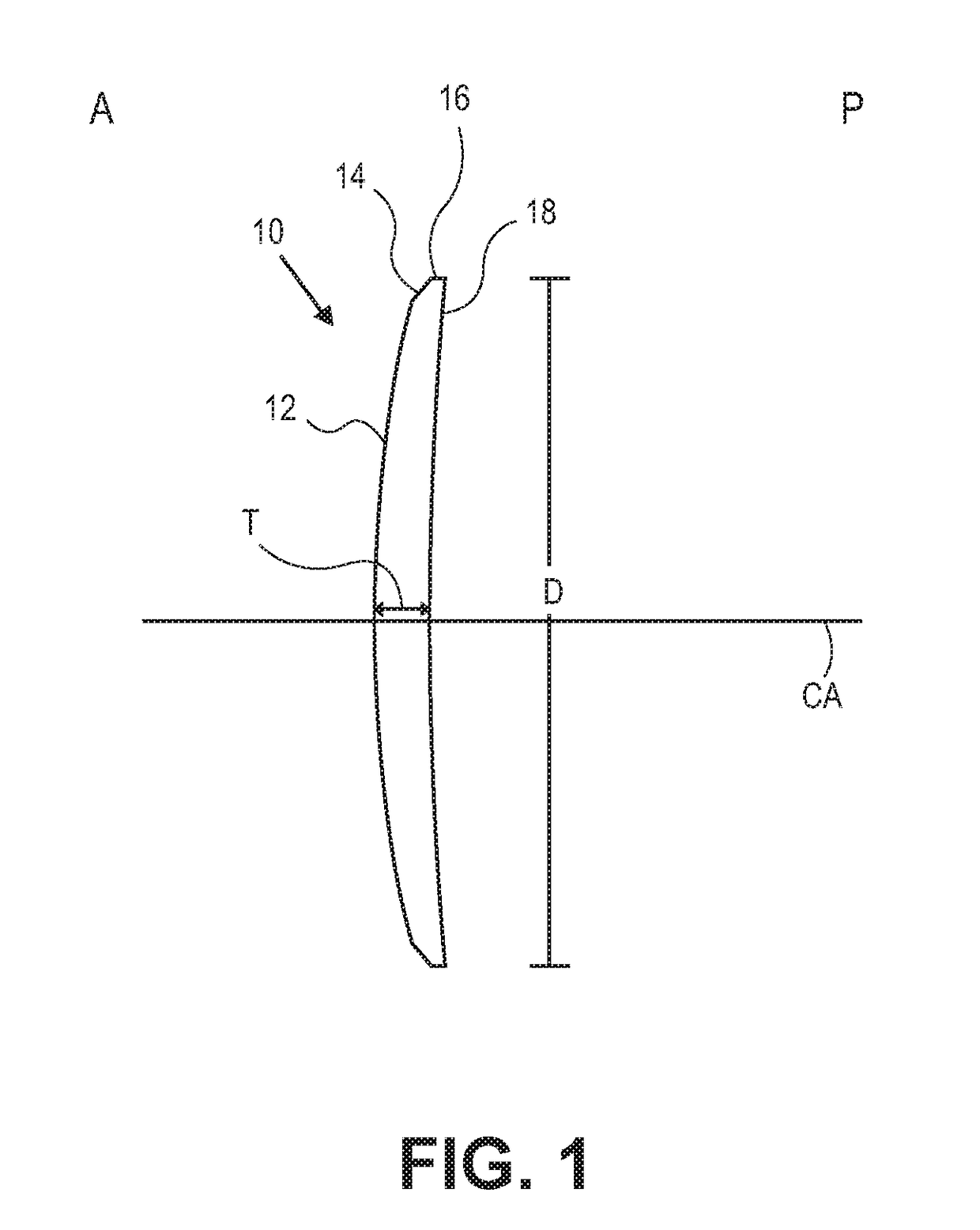 Methods of correcting vision