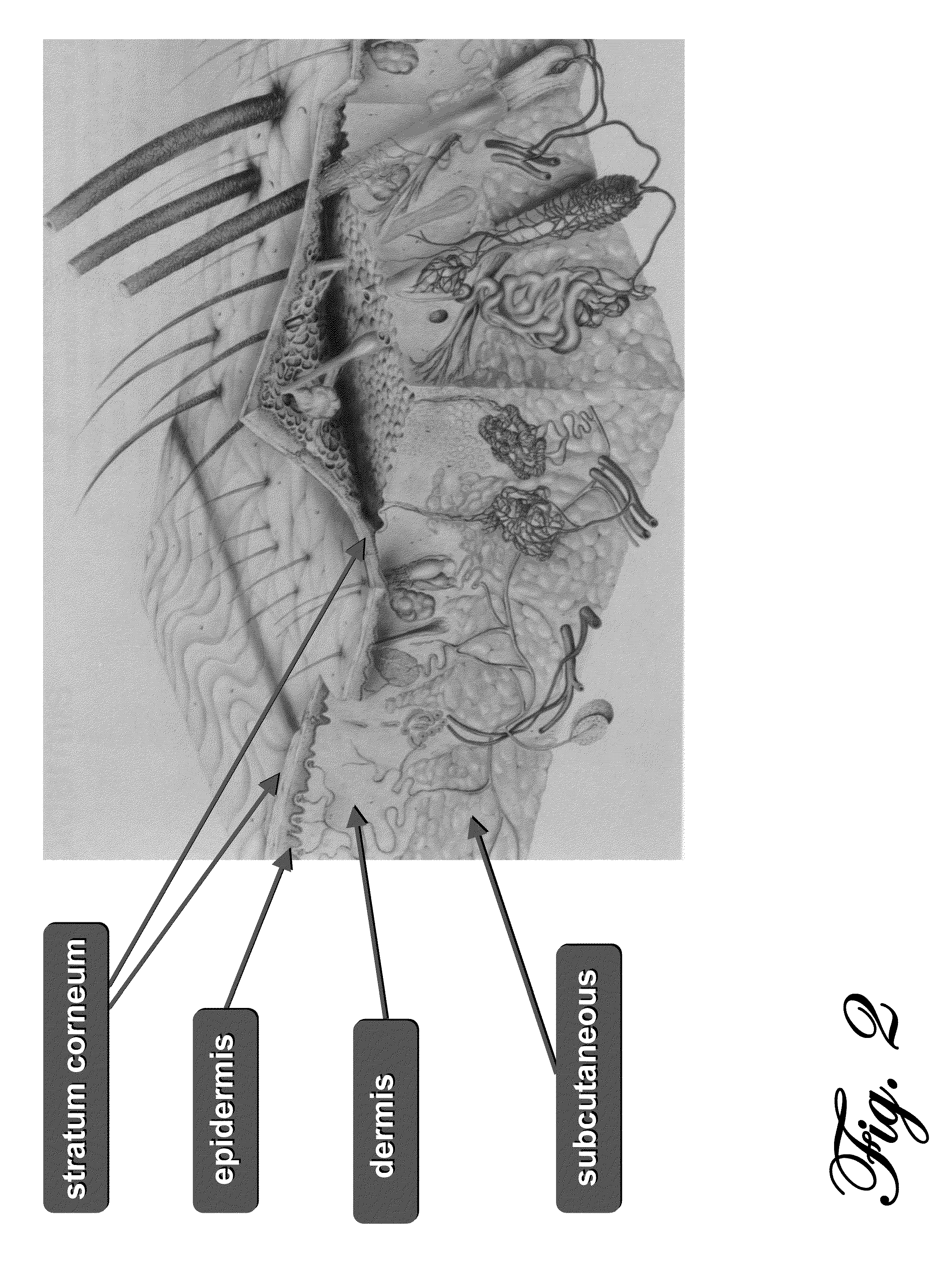 System for Noninvasive Determination of Analytes in Tissue