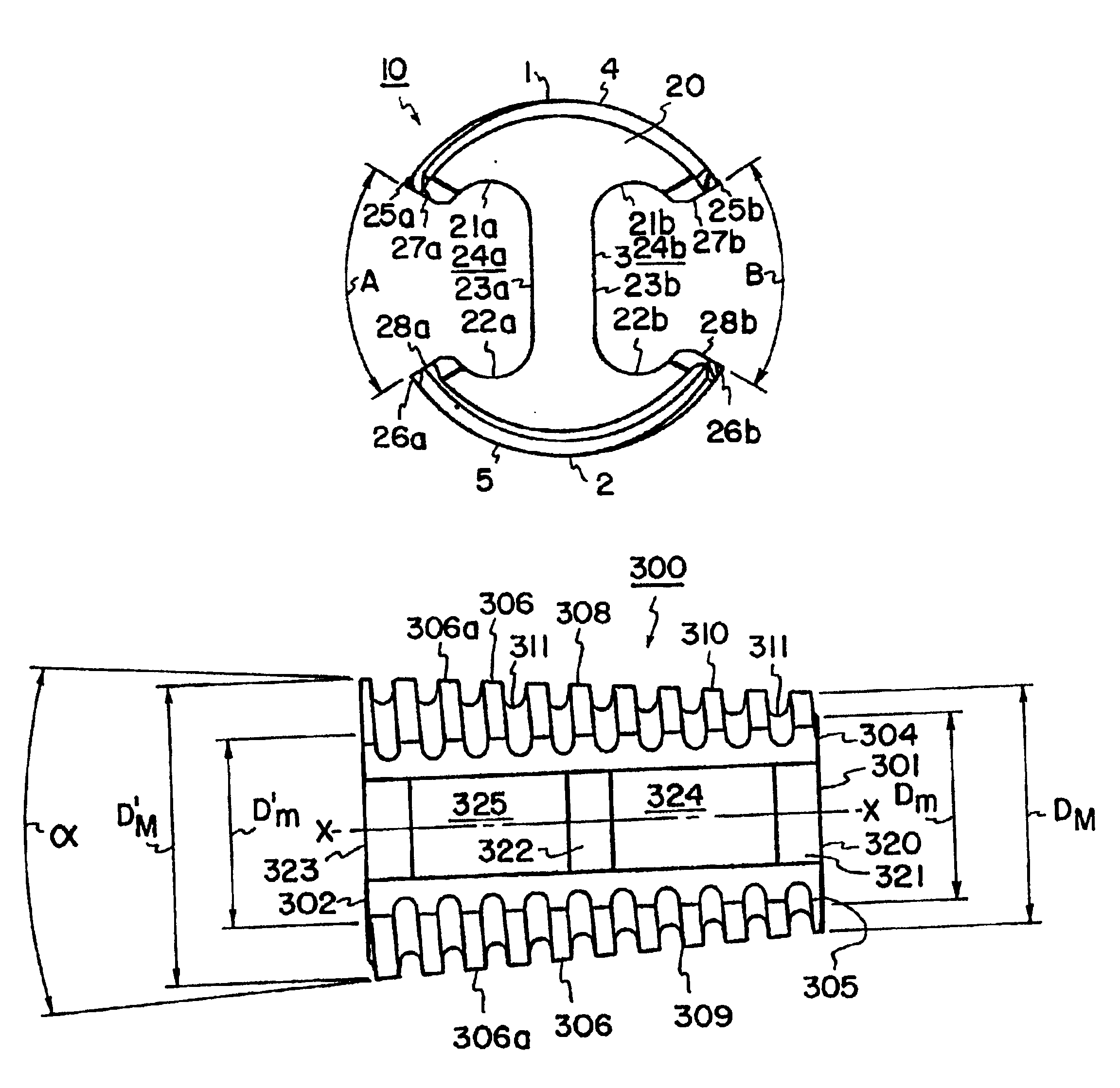 Intevertebral implant with reduced contact area and method