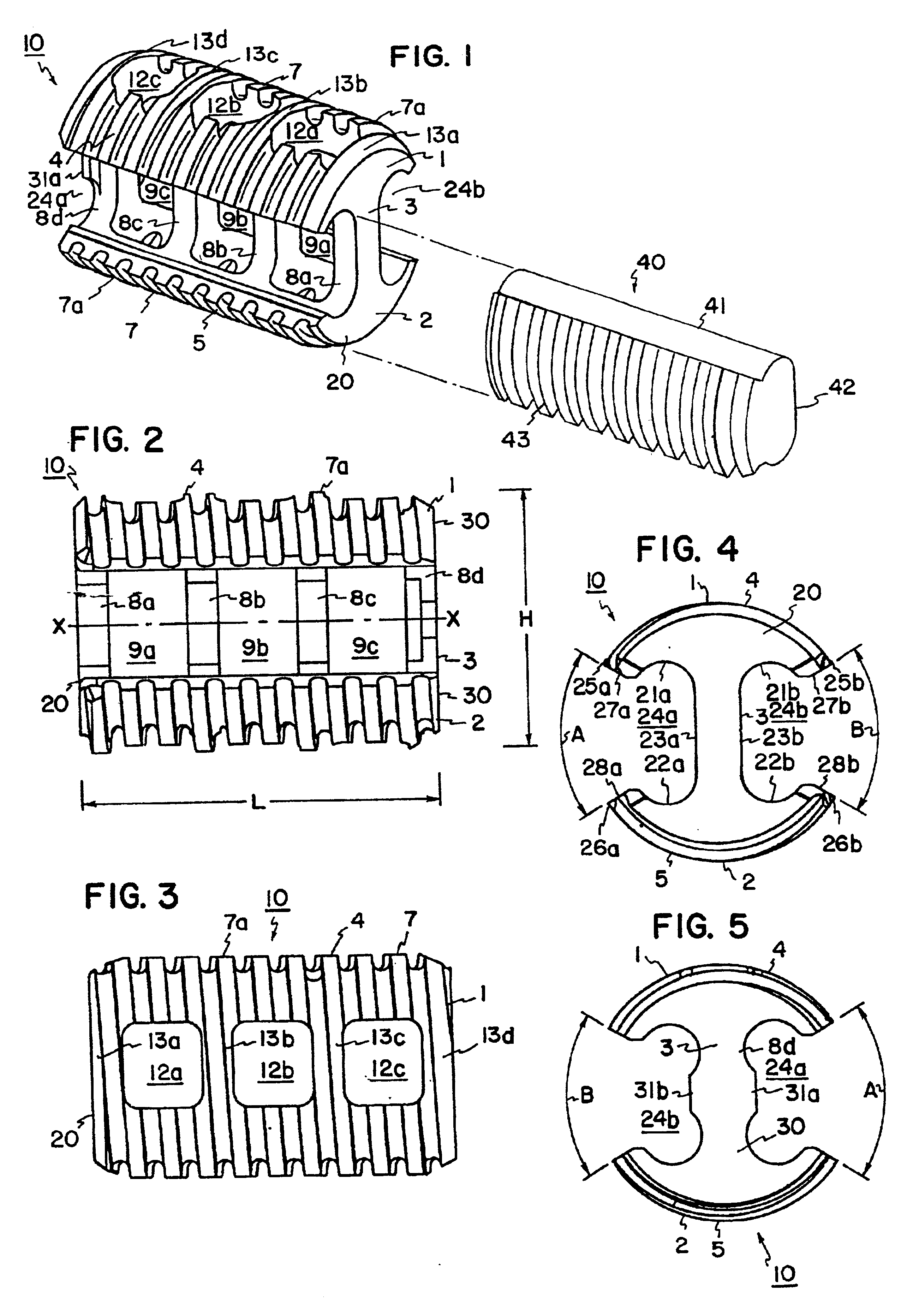 Intevertebral implant with reduced contact area and method