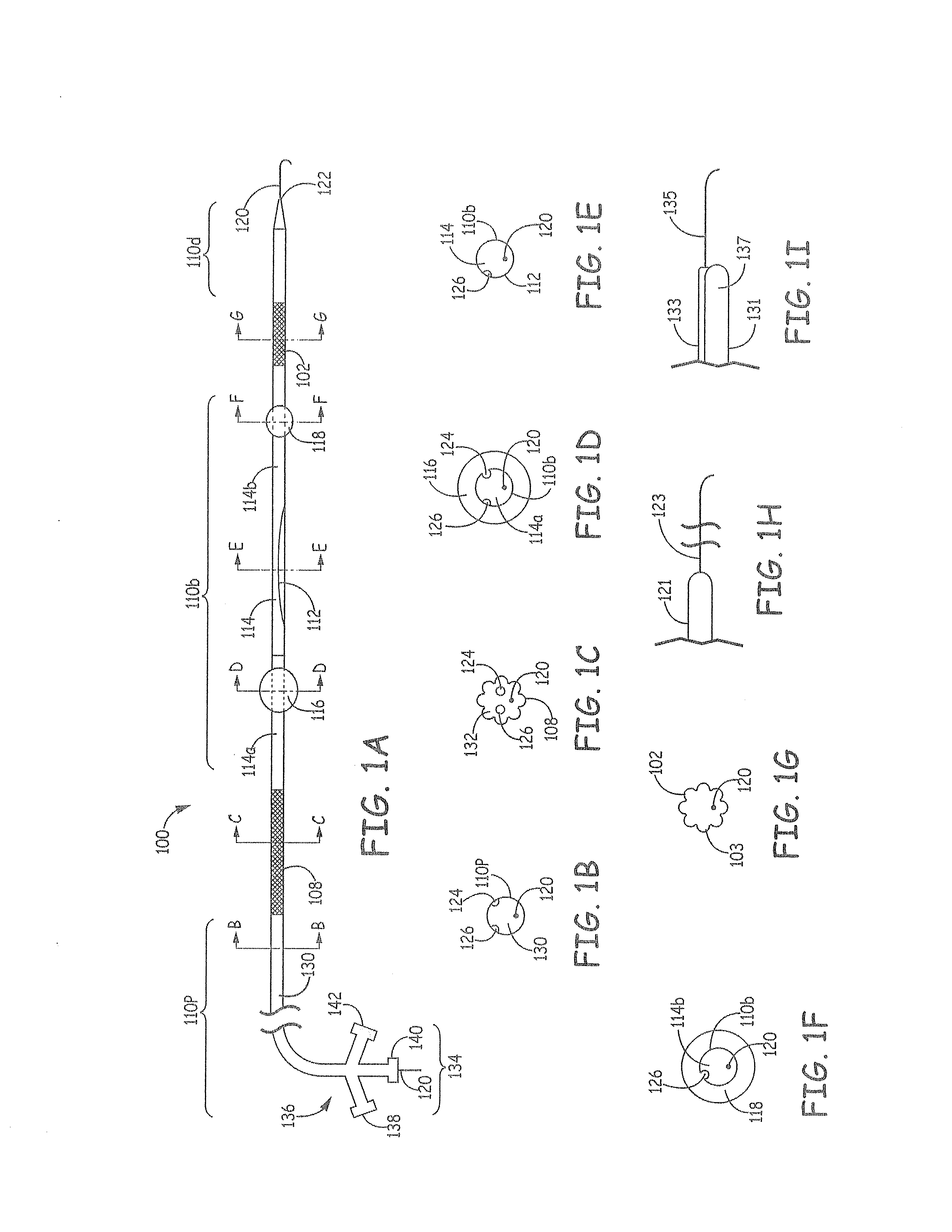 Aortic arch filtration system for carotid artery protection