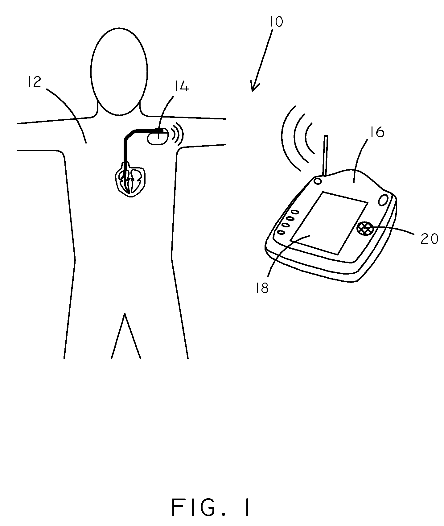 Devices and methods for respiration therapy