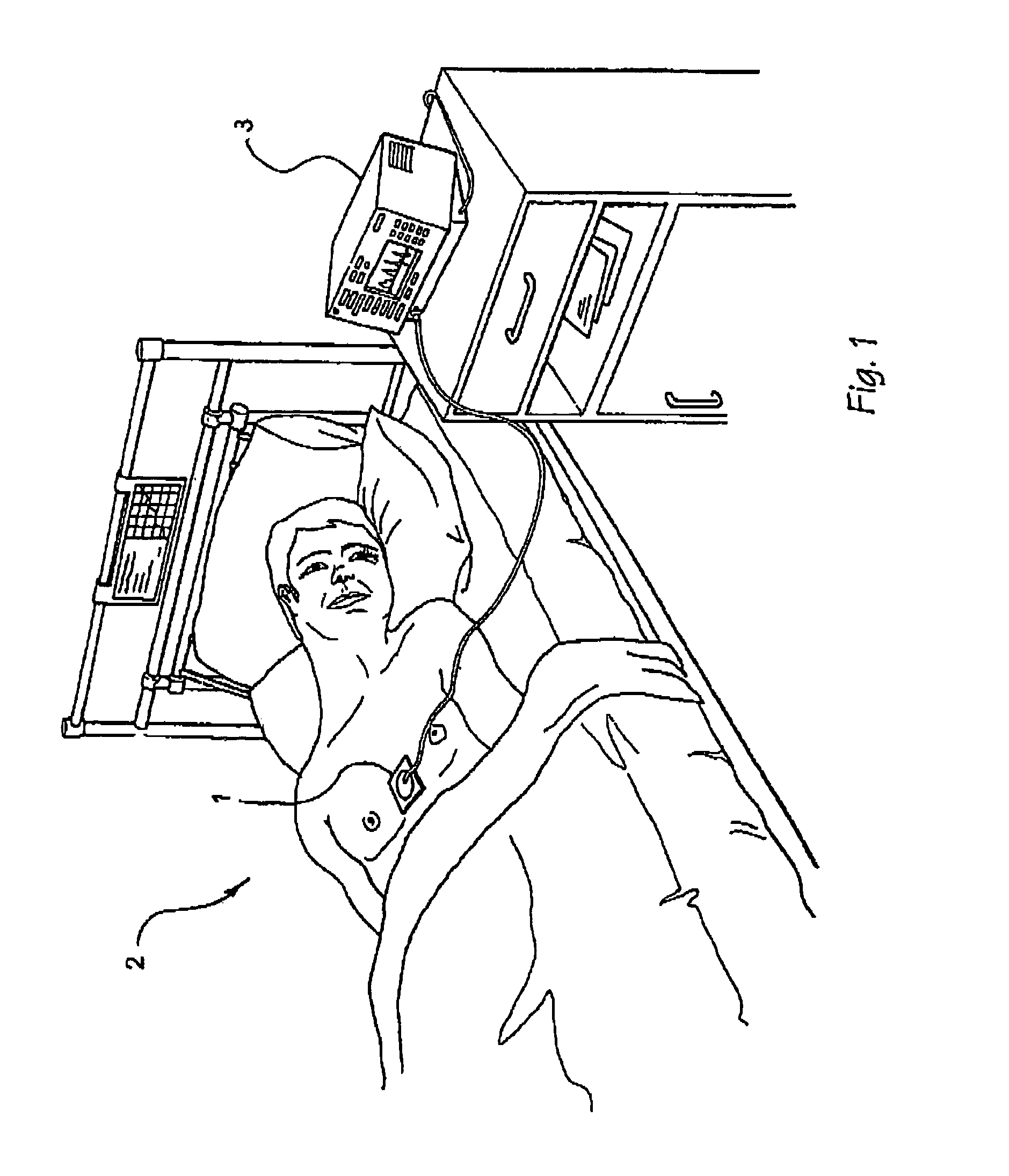 Methods and systems for determining cardiac output based on a valve cross sectional area estimate