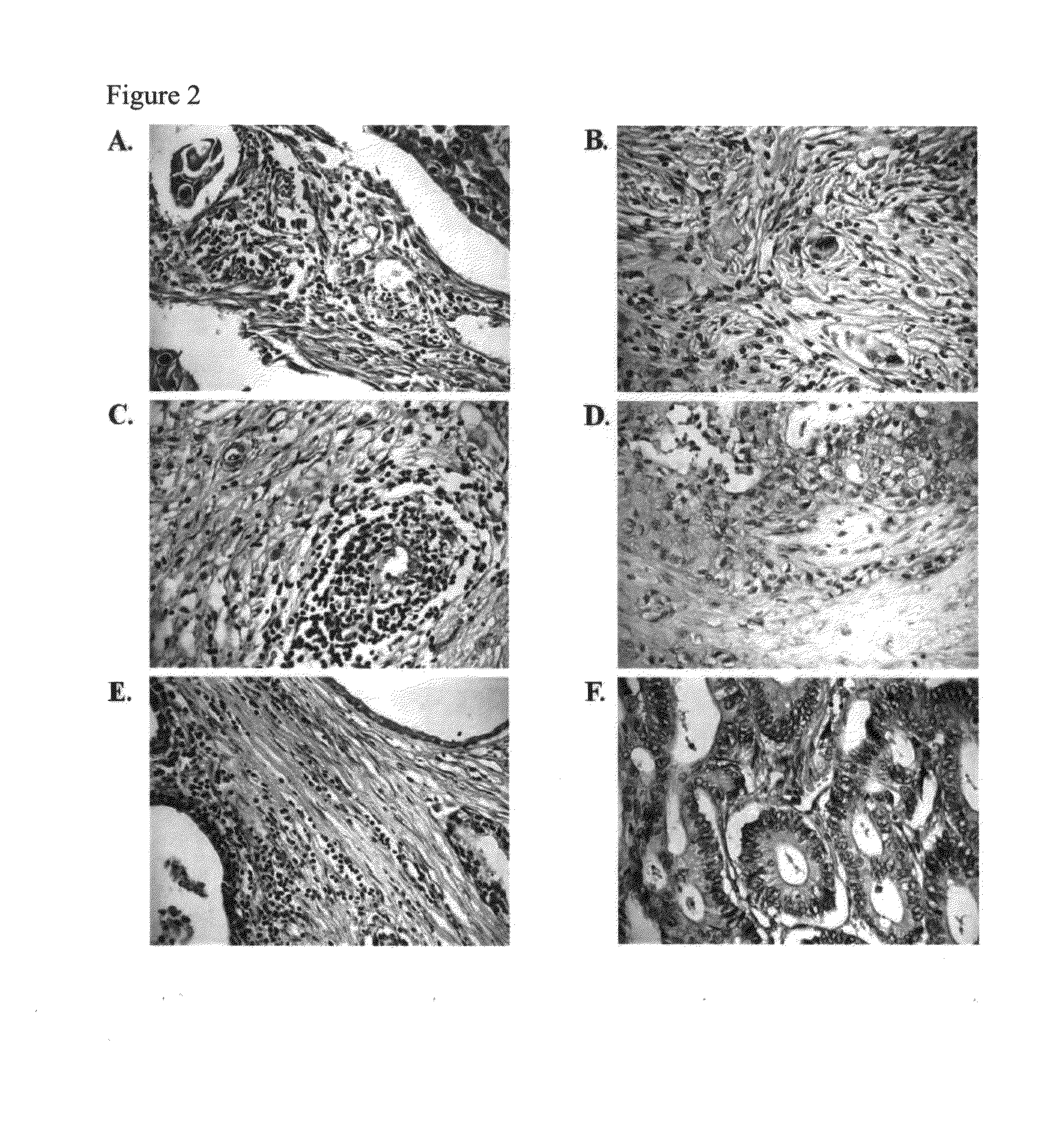 Kit and method of use of targeting peptide for diagnosis and therapy of cancer