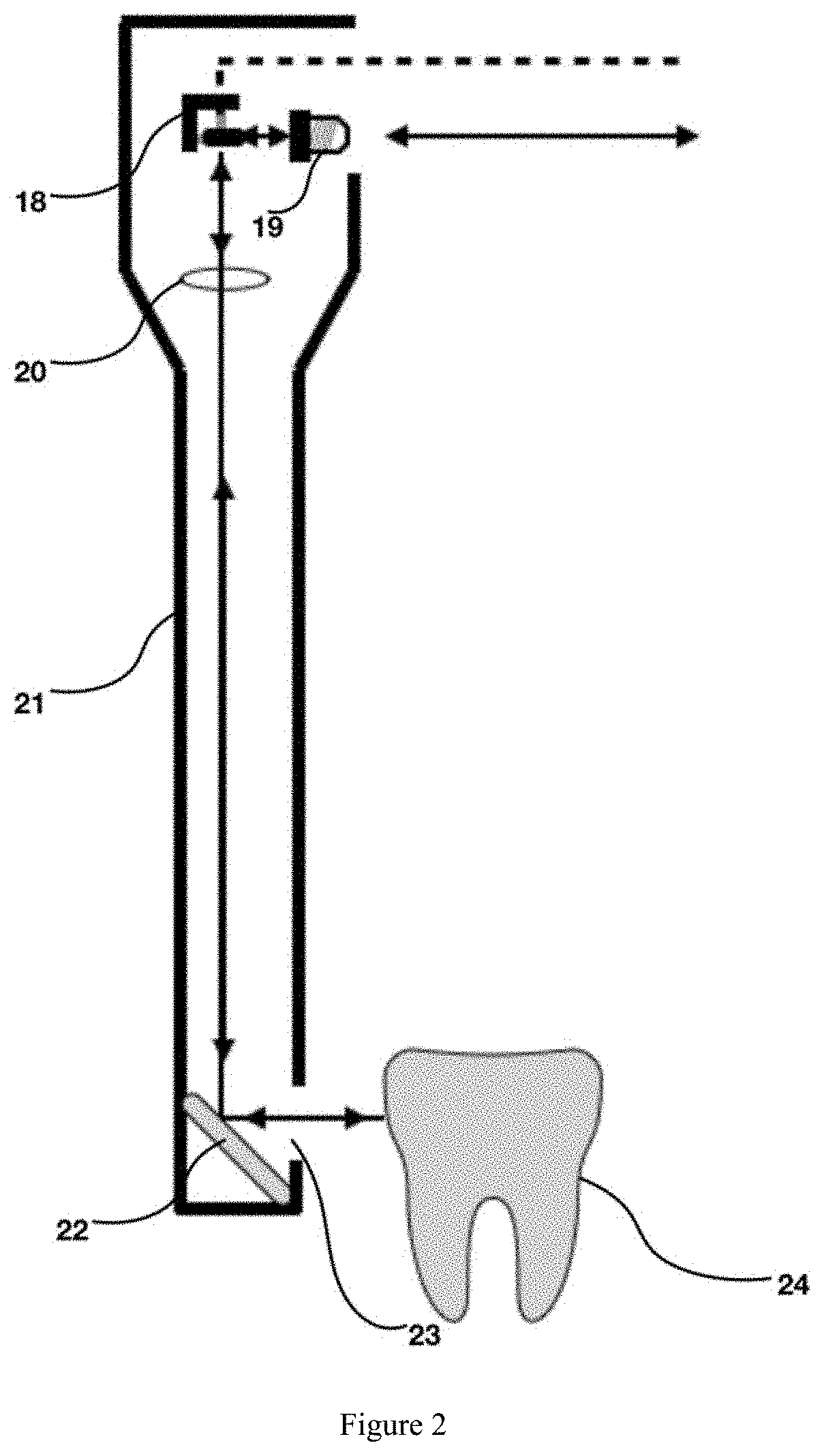 Visual imaging device based on ps-oct for early demineralization and caries of dental hard tissues