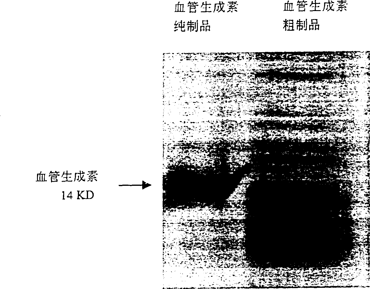 Peparation of human recombined blood-vessel generation element and skin whitening product