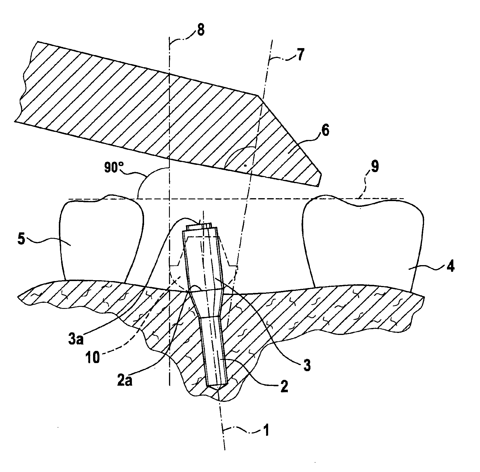 Method to determine position and orientation of the axis of a dental implant disposed directly in the mouth of the patient as well as a mounting piece