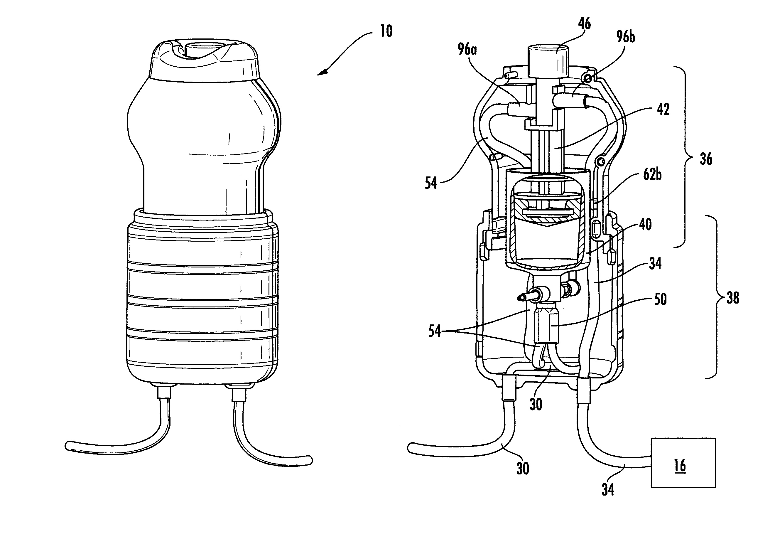 Bolus drug delivery device