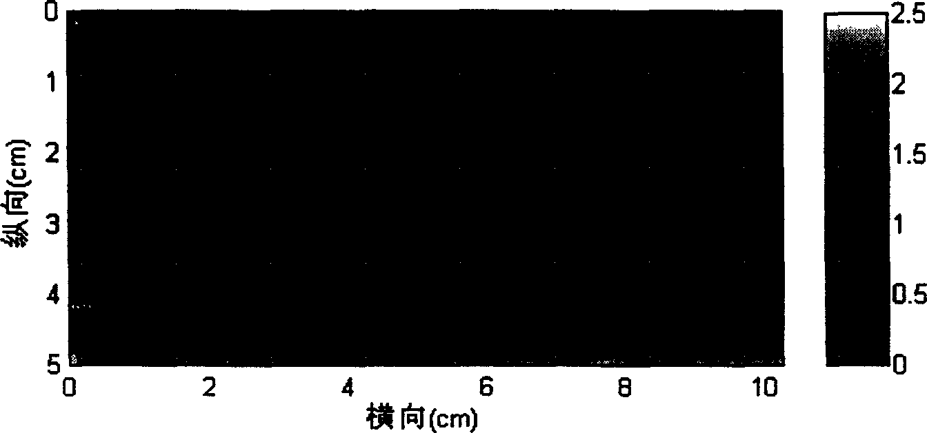 Balance pressure detector of supersonic elastic imaging