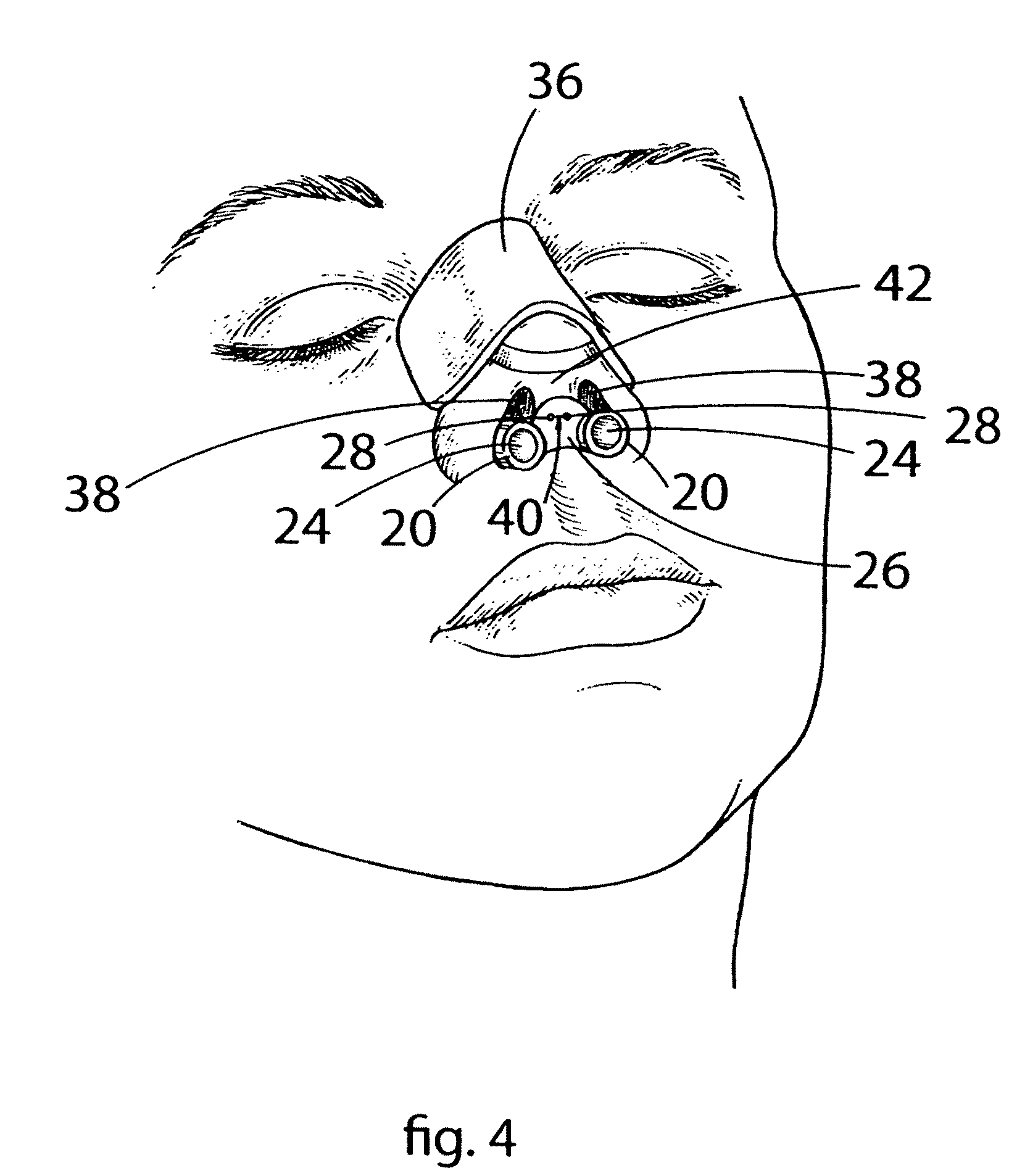 Device and method for maintaining unobstructed nasal passageways after nasal surgery