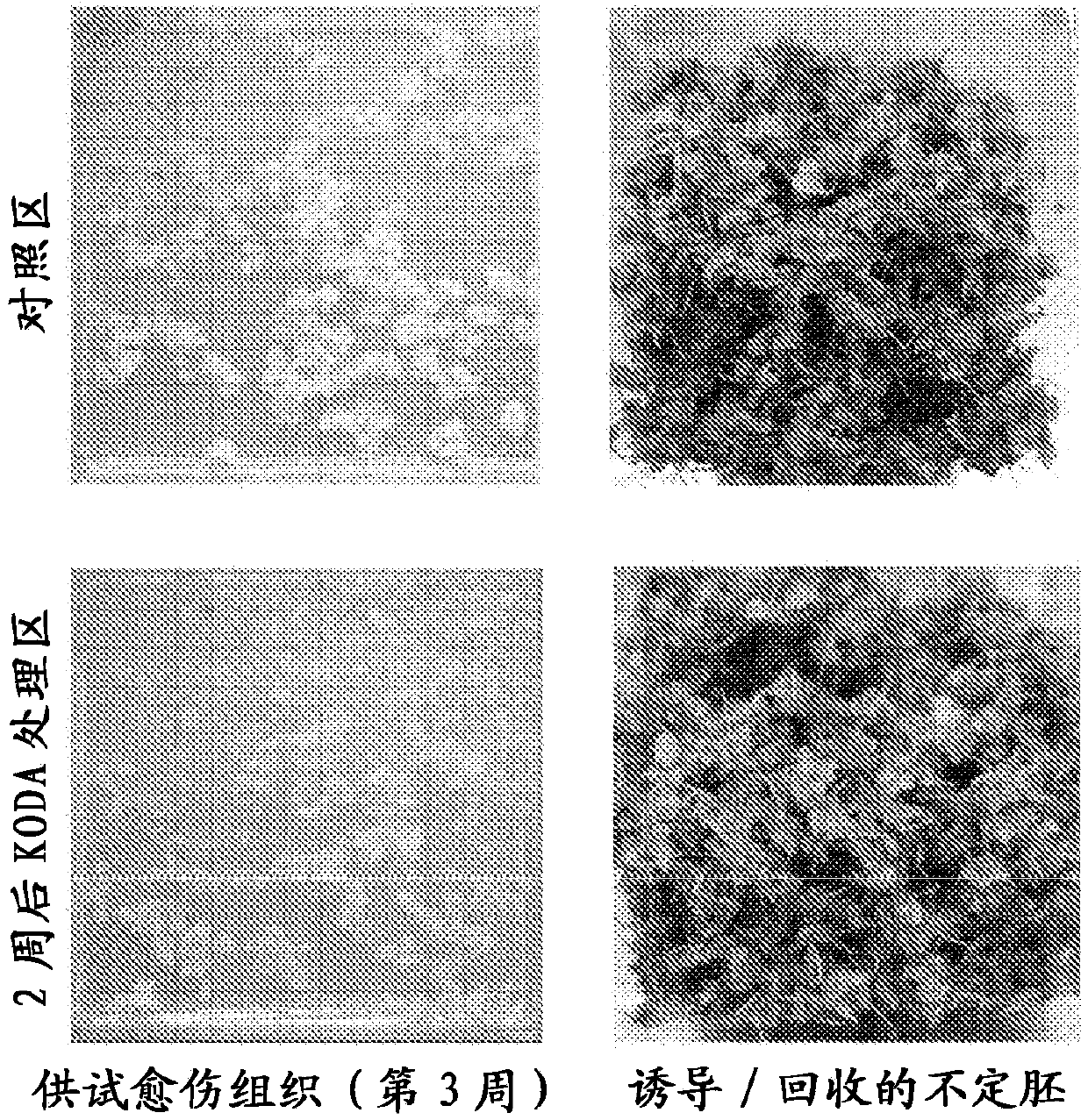 Plant cell differentiation promoter