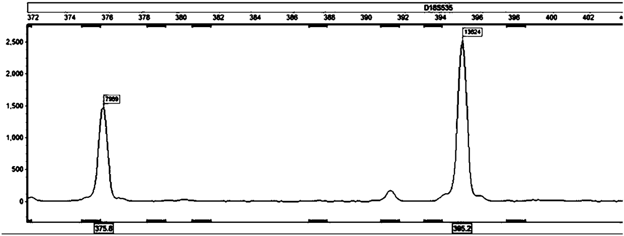 Amplification composition for detecting numerical abnormalities of chromosomes and fast detection kit