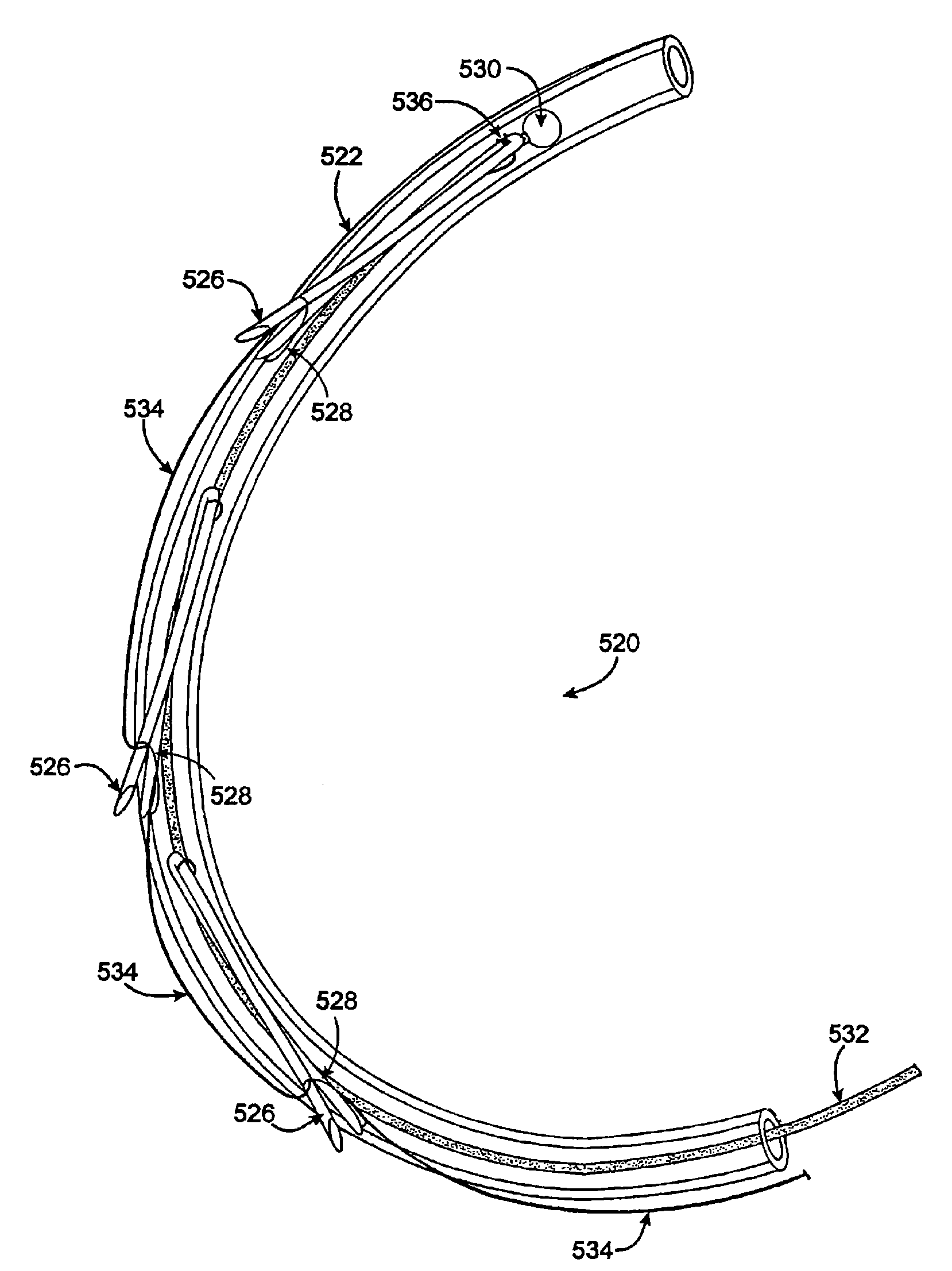 Multi-window guide tunnel