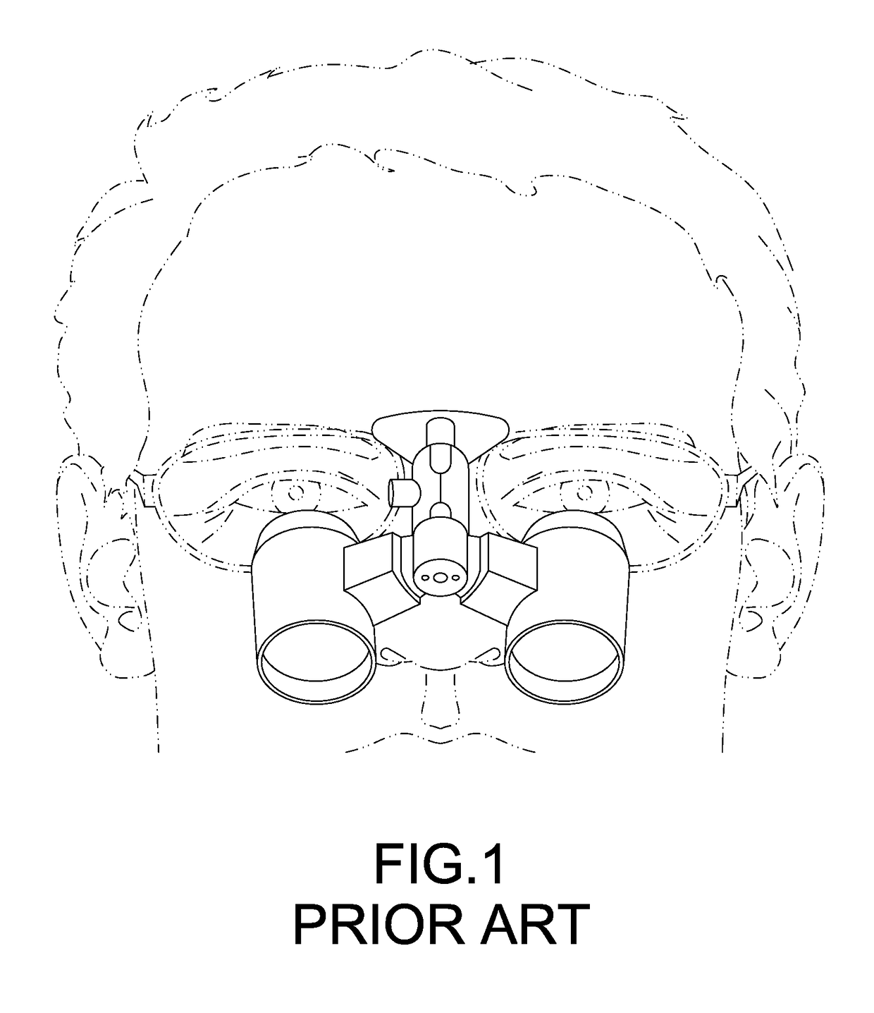 Digital loupe device