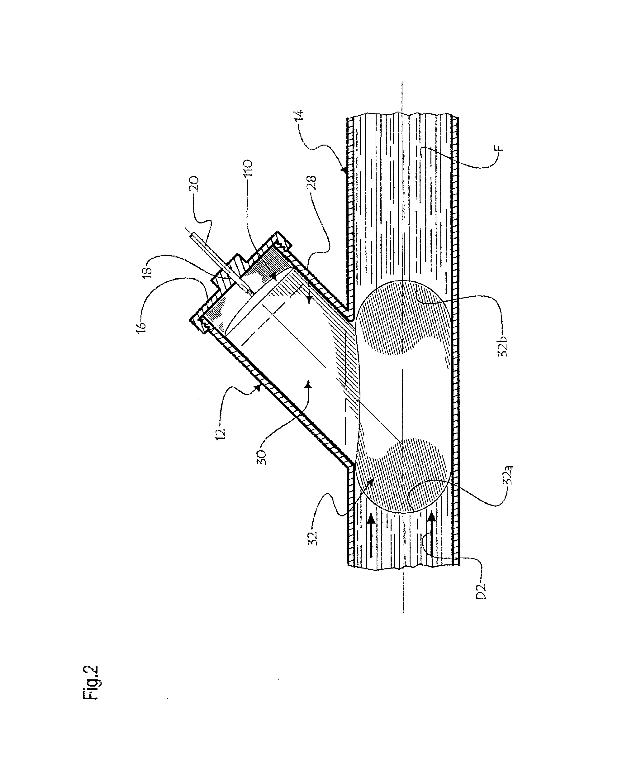 Fluid Backup Preventing System and Method of Use Thereof