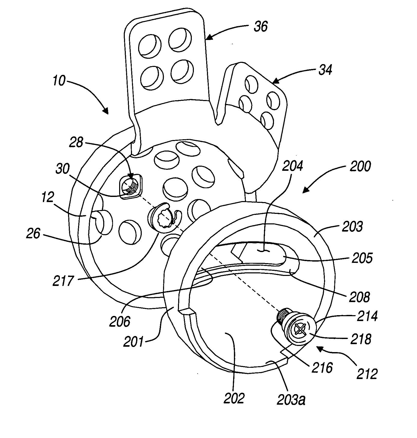 Method and apparatus for acetabular reconstruction