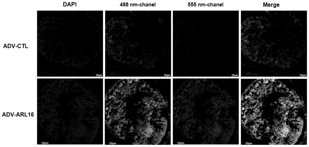 Application of ARL16 protein agonist in sperm flagellum multiple morphological abnormality under hypoxia