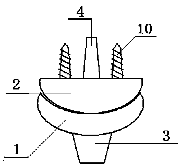 Externally clamping fixed high-functionality artificial wrist joint prosthesis device