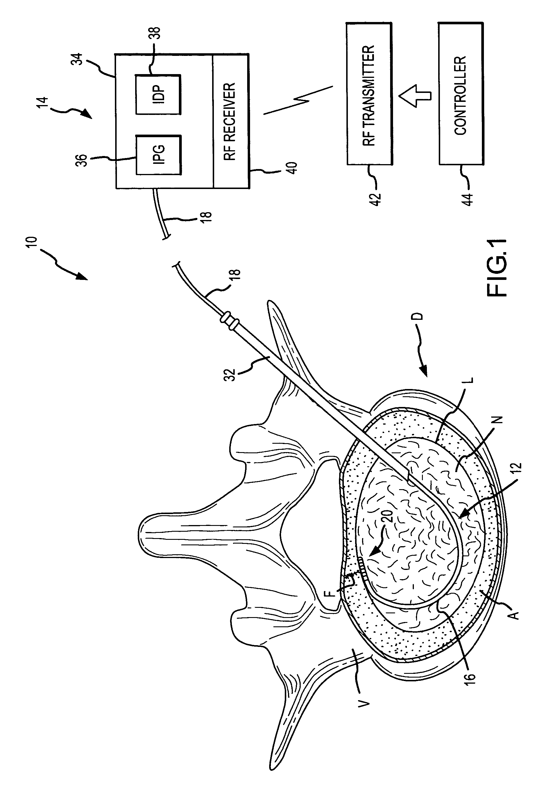 Combination electrical stimulating and infusion medical device and method