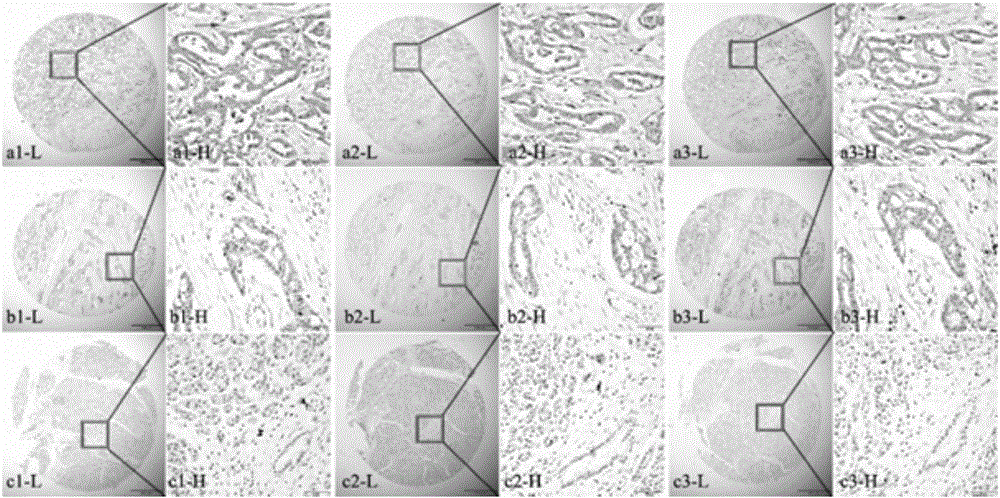 Preparation and application of triple artificial miRNA in restraining of VEGFRs