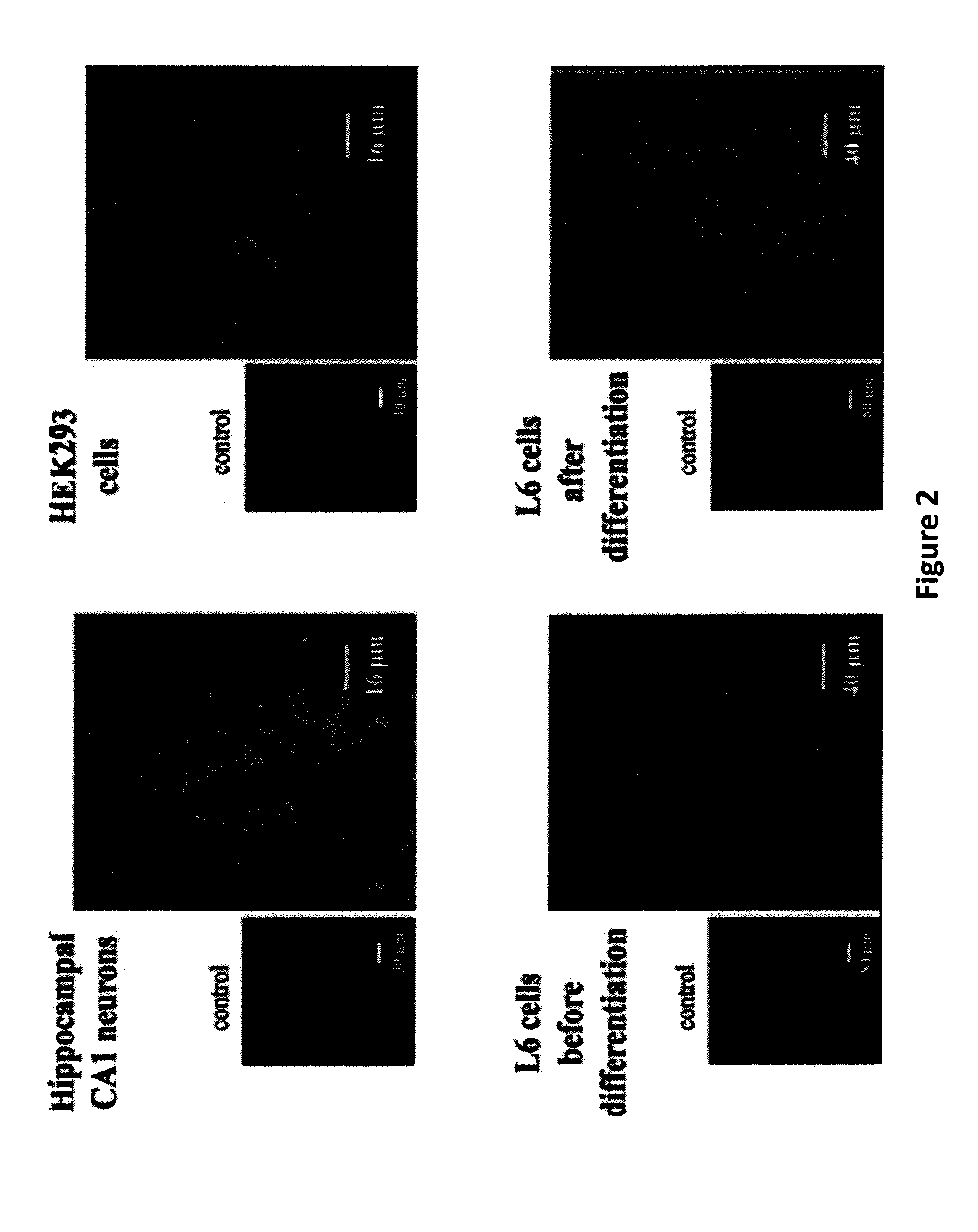 Peptides derived from maurocalcine used as vectors for intracellular addressing of molecules of interest