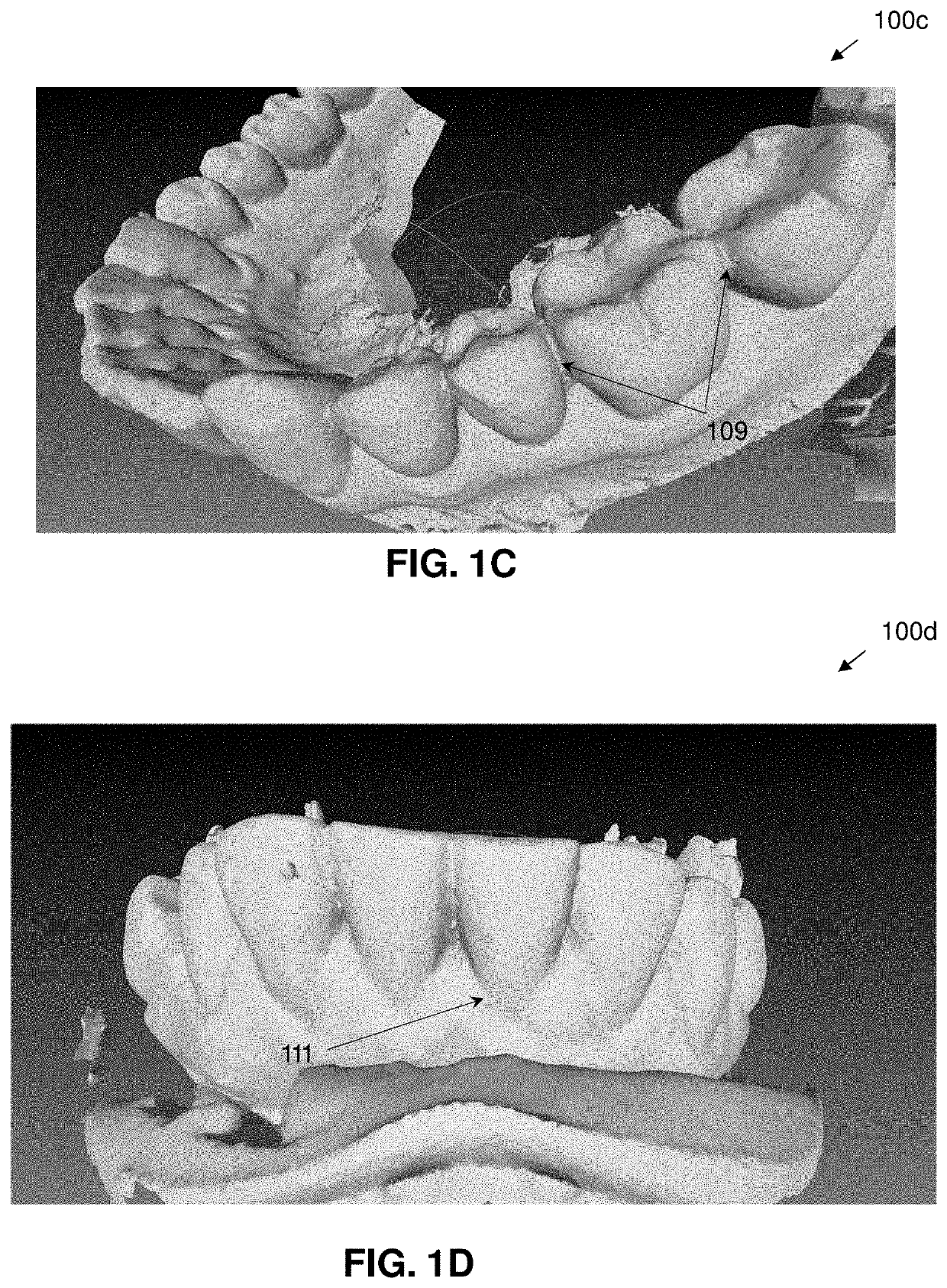 Artificially intelligent systems to manage virtual dental models using dental images