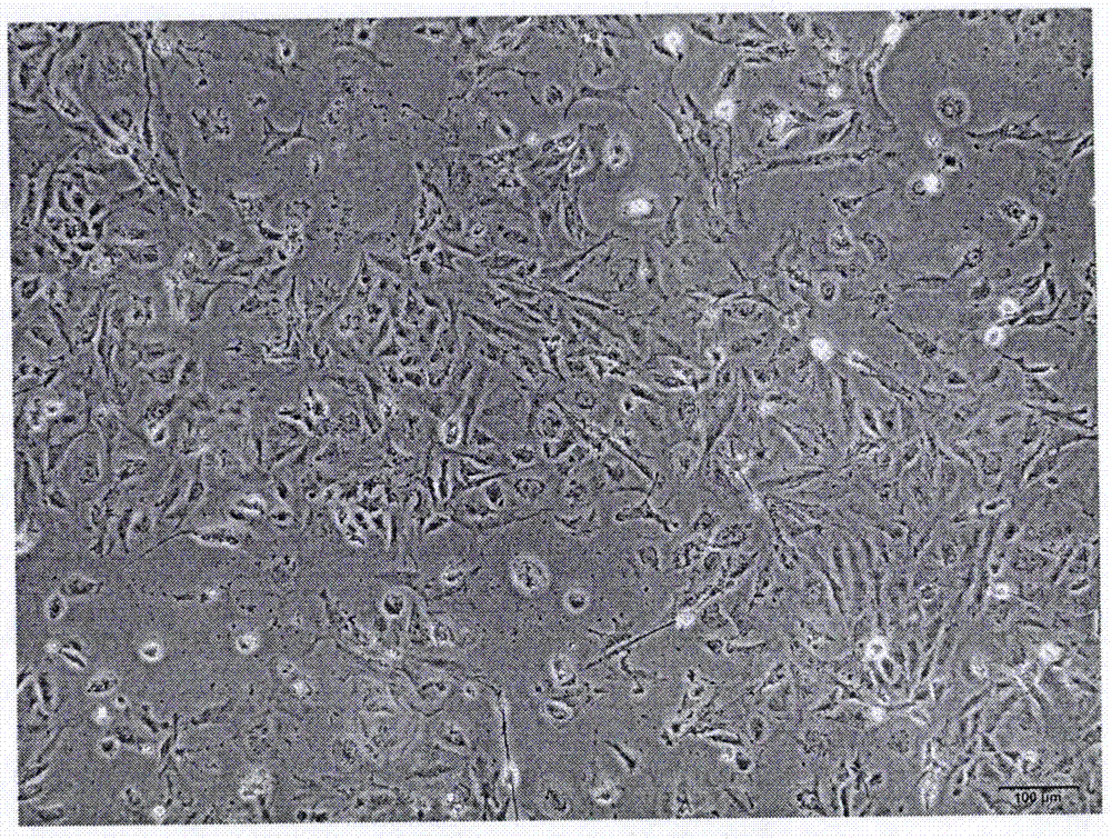 Method for separating and culturing mouse ovarian granule cells