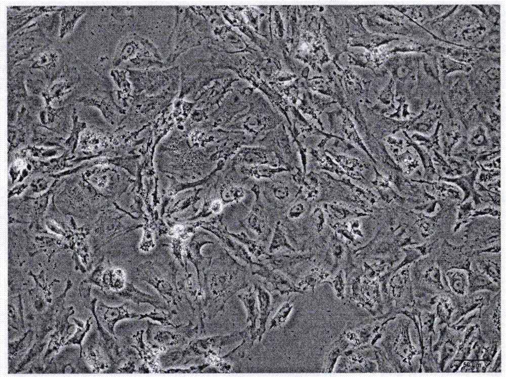 Method for separating and culturing mouse ovarian granule cells