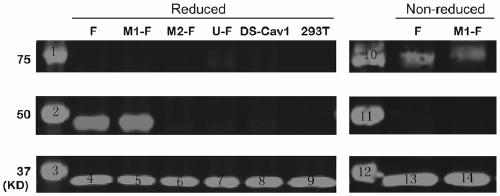 Respiratory syncytial virus pre-fusion F protein and application thereof