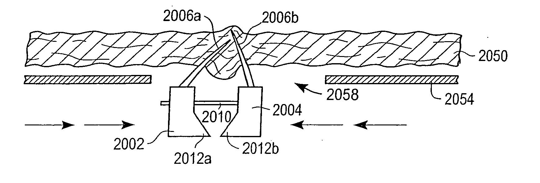 Method and apparatus for performing catheter-based annuloplasty using local plications