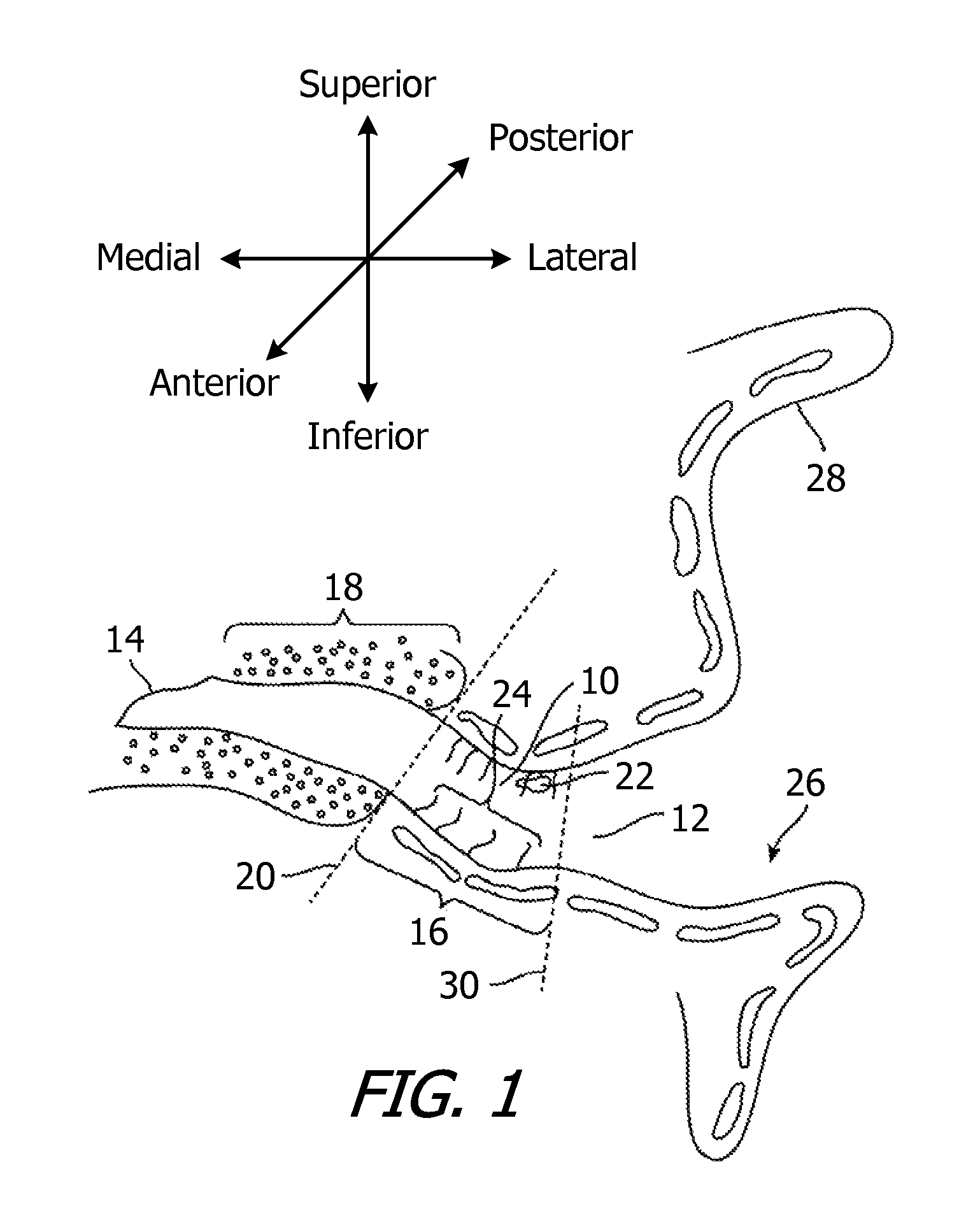 Canal hearing devices and batteries for use with same