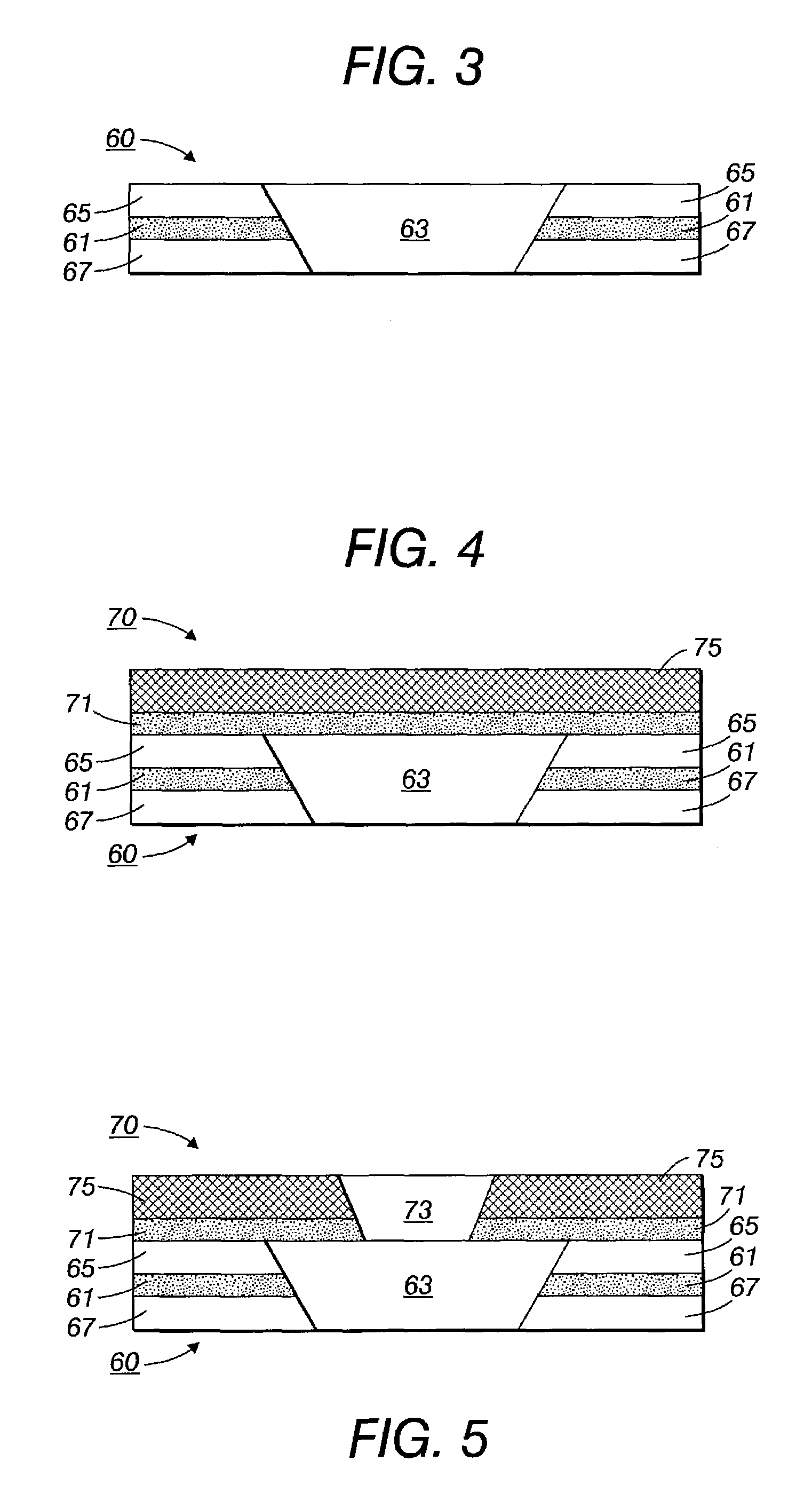 Standoff/mask structure for electrical interconnect