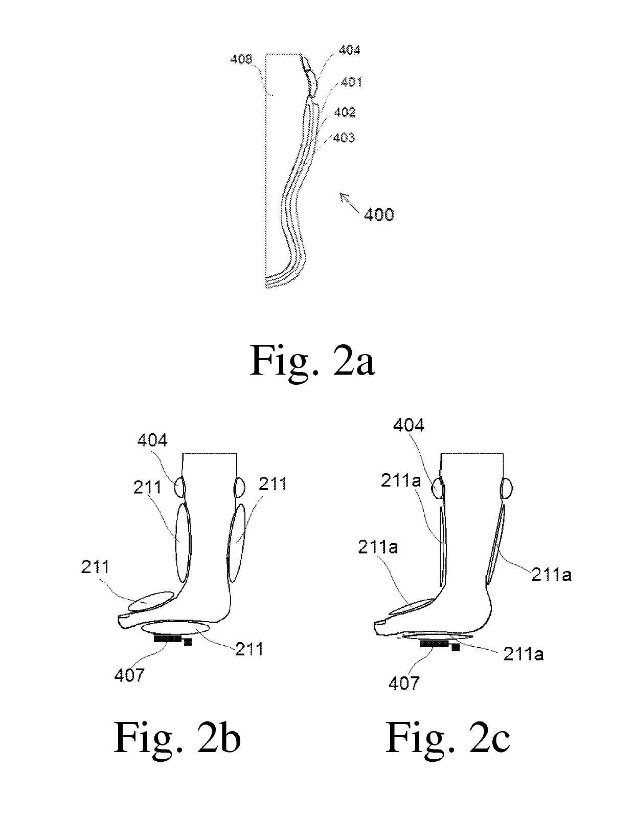 Devices for functional revascularization by alternating pressure