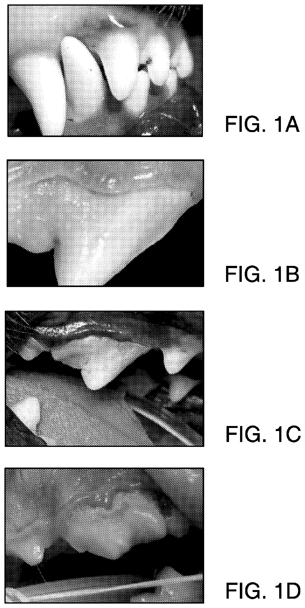 Method or system for diagnosing periodontal disease