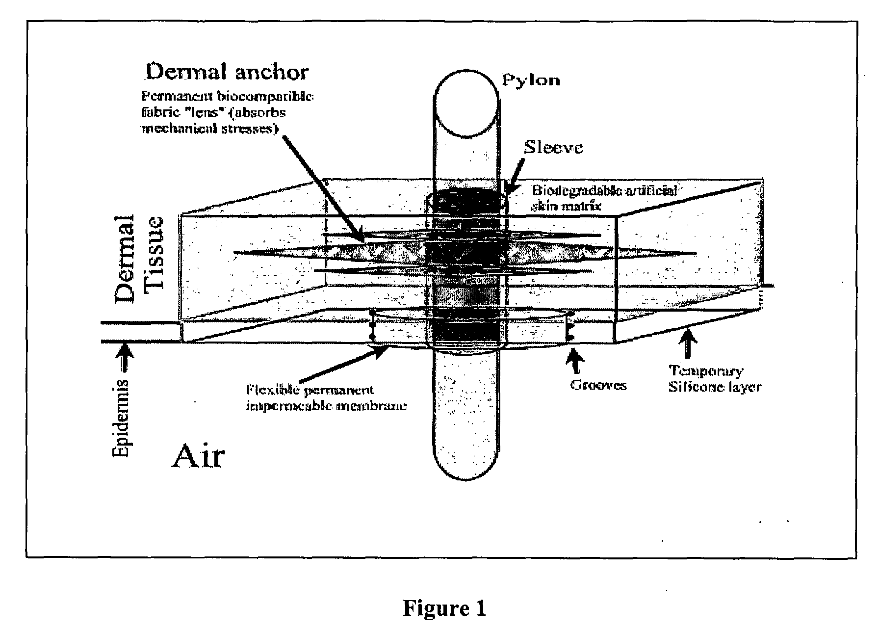 Wound Closure System and Methods