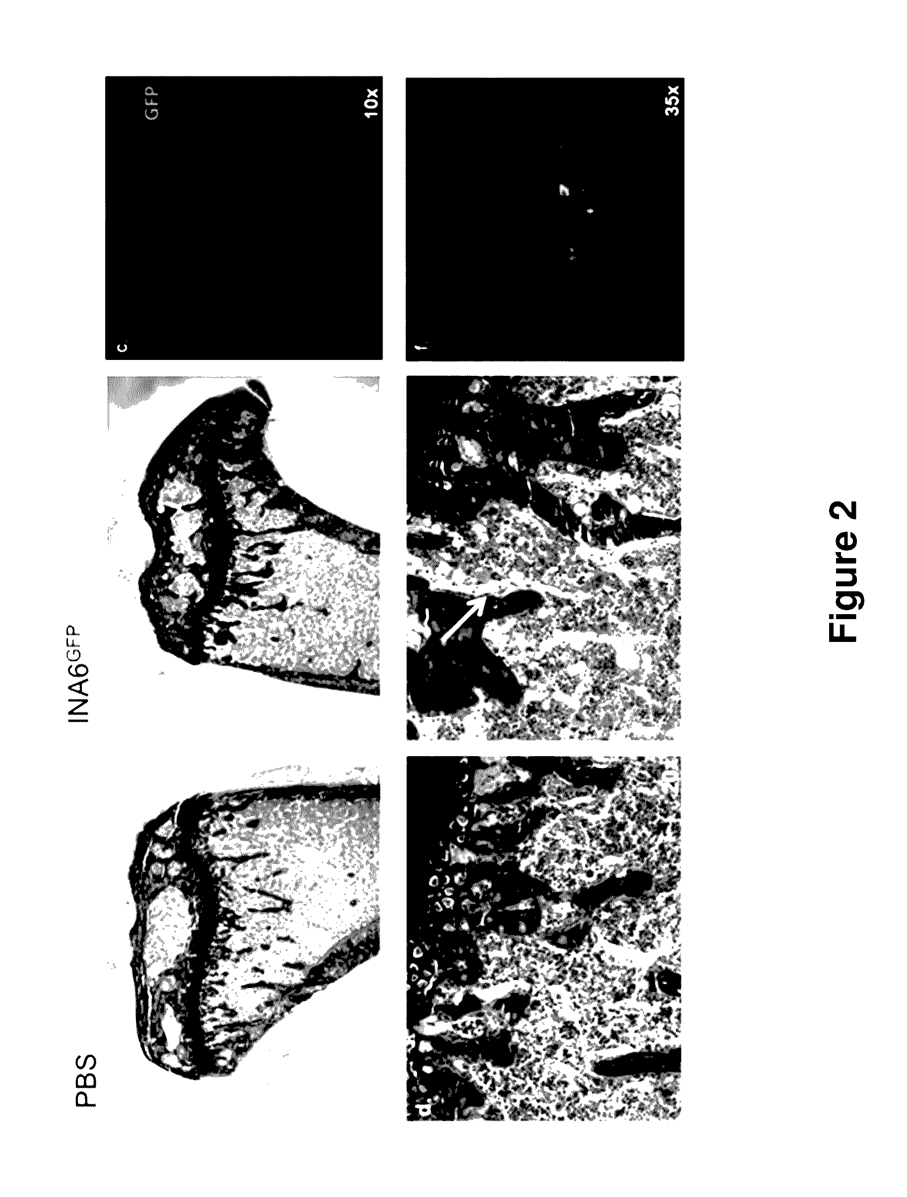 Genetically modified non-human animals and methods of use thereof